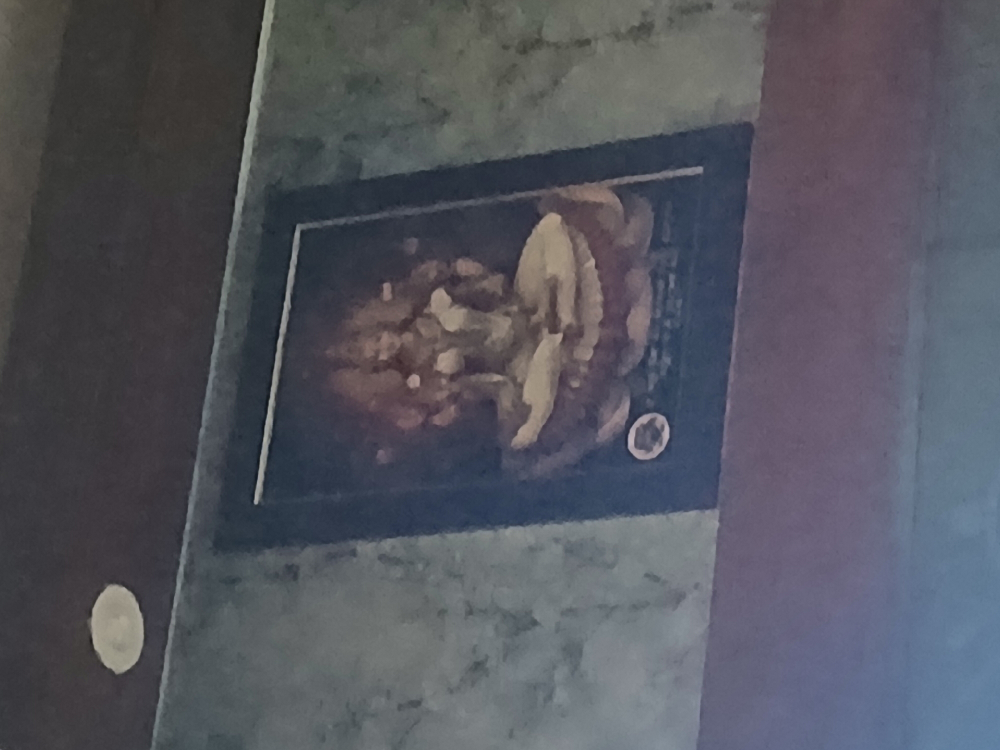 A framed artwork hangs on a wall with a textured, possibly painted finish. The artwork appears to depict a collection of objects or food items, potentially arranged in a still life. The artwork has a dark frame and is positioned in the center of the image. The surrounding wall is a mottled gray-green color. The image appears to be an interior shot. The location in Bengaluru, India, cannot be determined from the provided image.