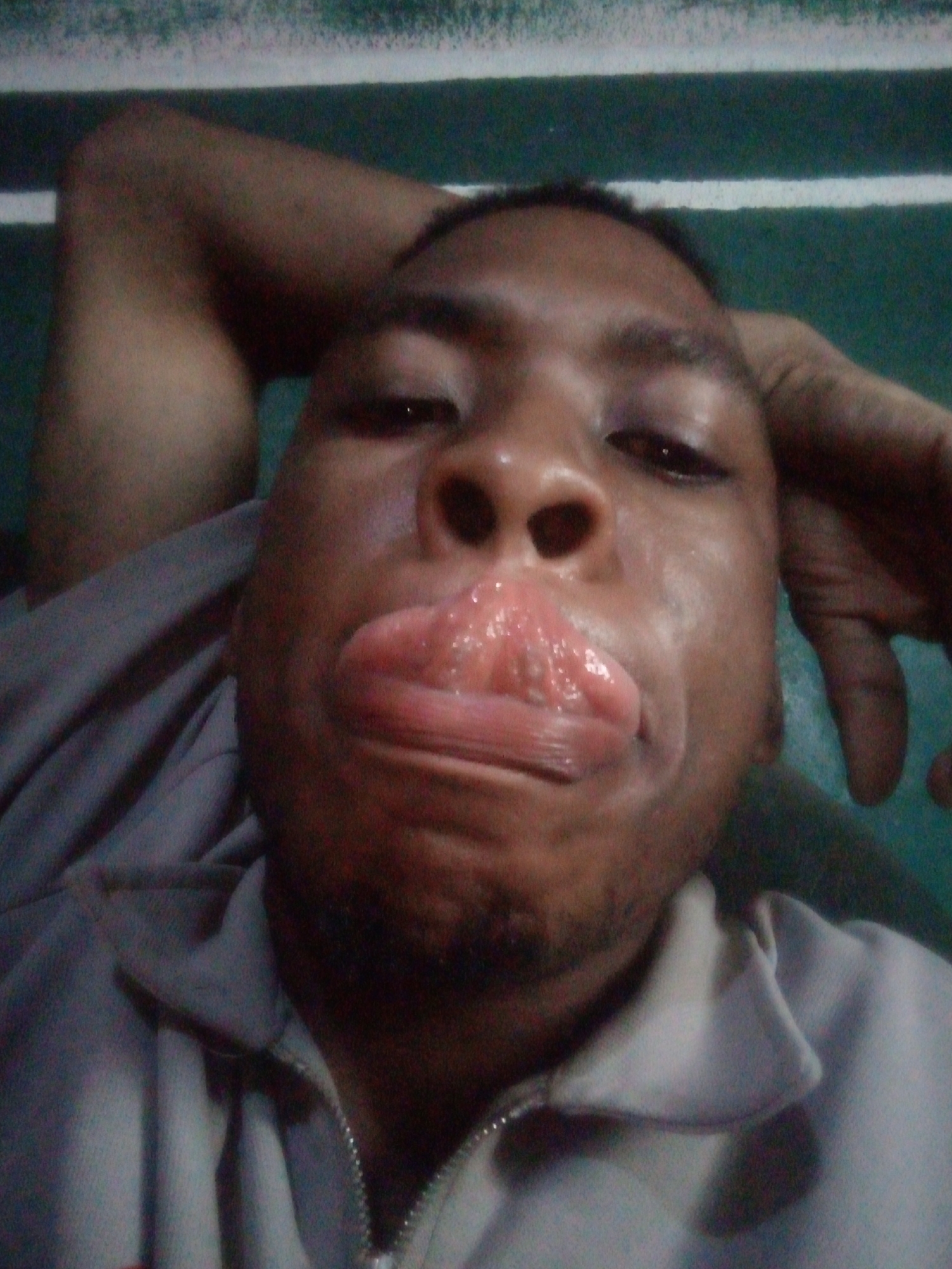A close-up, slightly distorted, selfie-style image of a Black male. He has dark hair, dark eyes, and is wearing a gray collared shirt with a zipper. His lips are swollen and coated with a clear, possibly glistening substance. His arm is raised behind his head, resting on a green surface with white lines. The location is unknown.