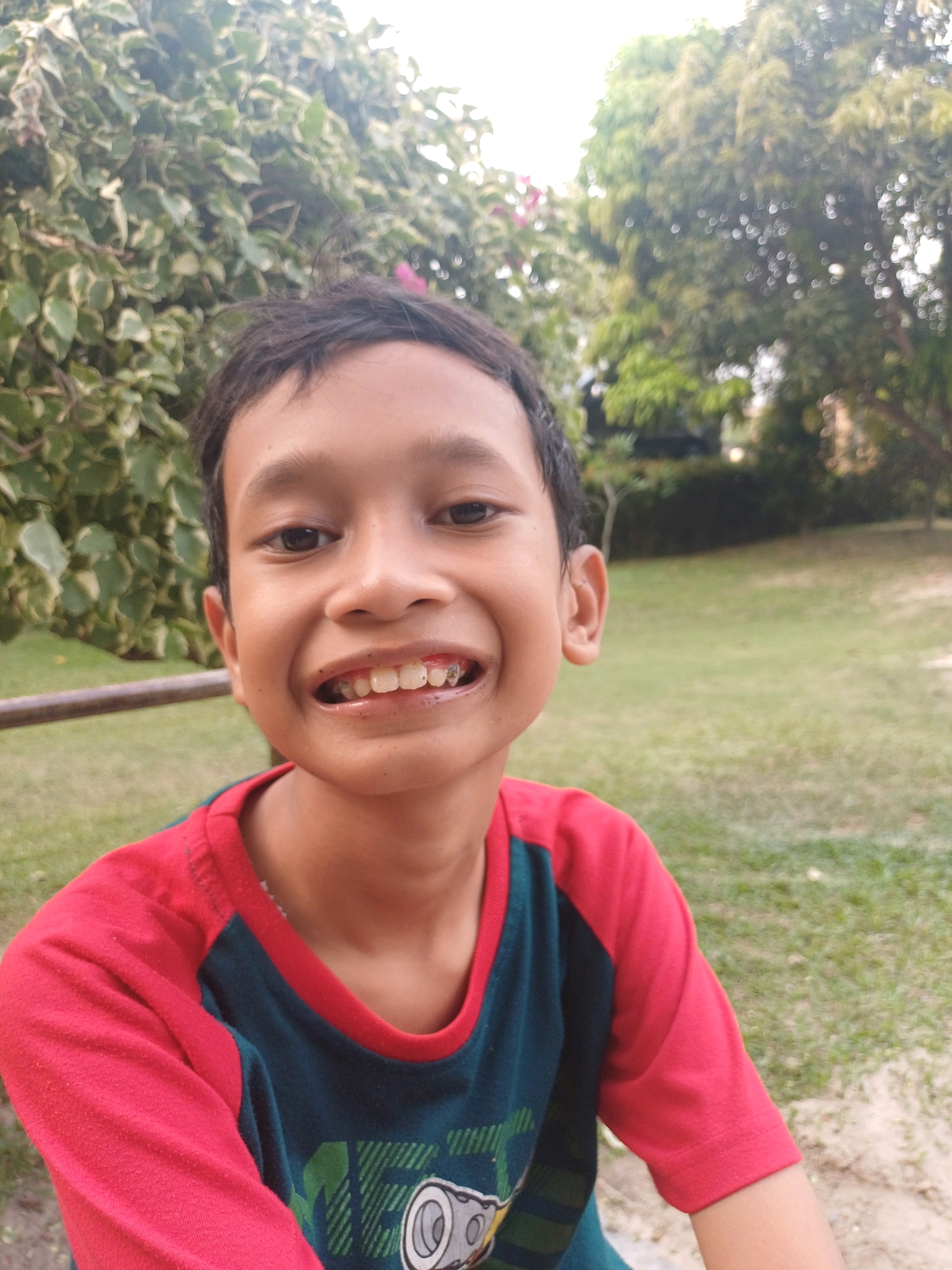 A young boy is smiling for a selfie outdoors. He is wearing a red and blue t-shirt. The background consists of lush green trees and foliage, suggesting a park or garden setting. The lighting indicates it is daytime, possibly late afternoon given the soft sunlight filtering through the leaves. The boy's teeth are visible, and there appears to be some dirt or food residue on them. He is positioned centrally in the frame, with the camera angled slightly upwards. The overall scene conveys a casual and happy moment captured in nature. There is no indication of the city of Dumai, Indonesia in the image.