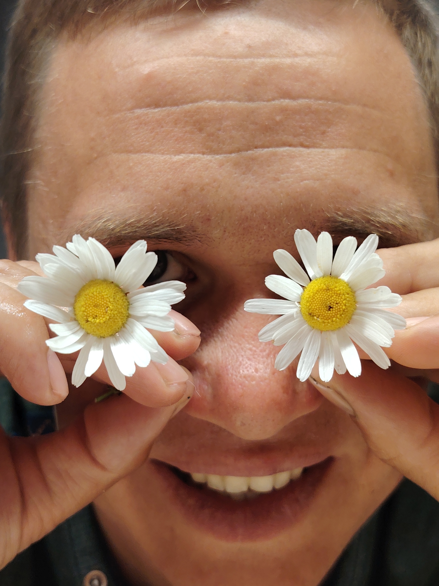 The image is a close-up, eye-level shot of a person holding two daisies over their eyes. The person's forehead, eyes, nose, and mouth are visible. The skin on the forehead shows several horizontal wrinkles. The daisies, with white petals and yellow centers, are positioned to obscure the eyes. The person's hands are visible, holding the flowers in place. The background is dark and out of focus, with a hint of hair visible at the top of the frame. The image does not provide any information about the location in the city of Chaikovsky, Russia.