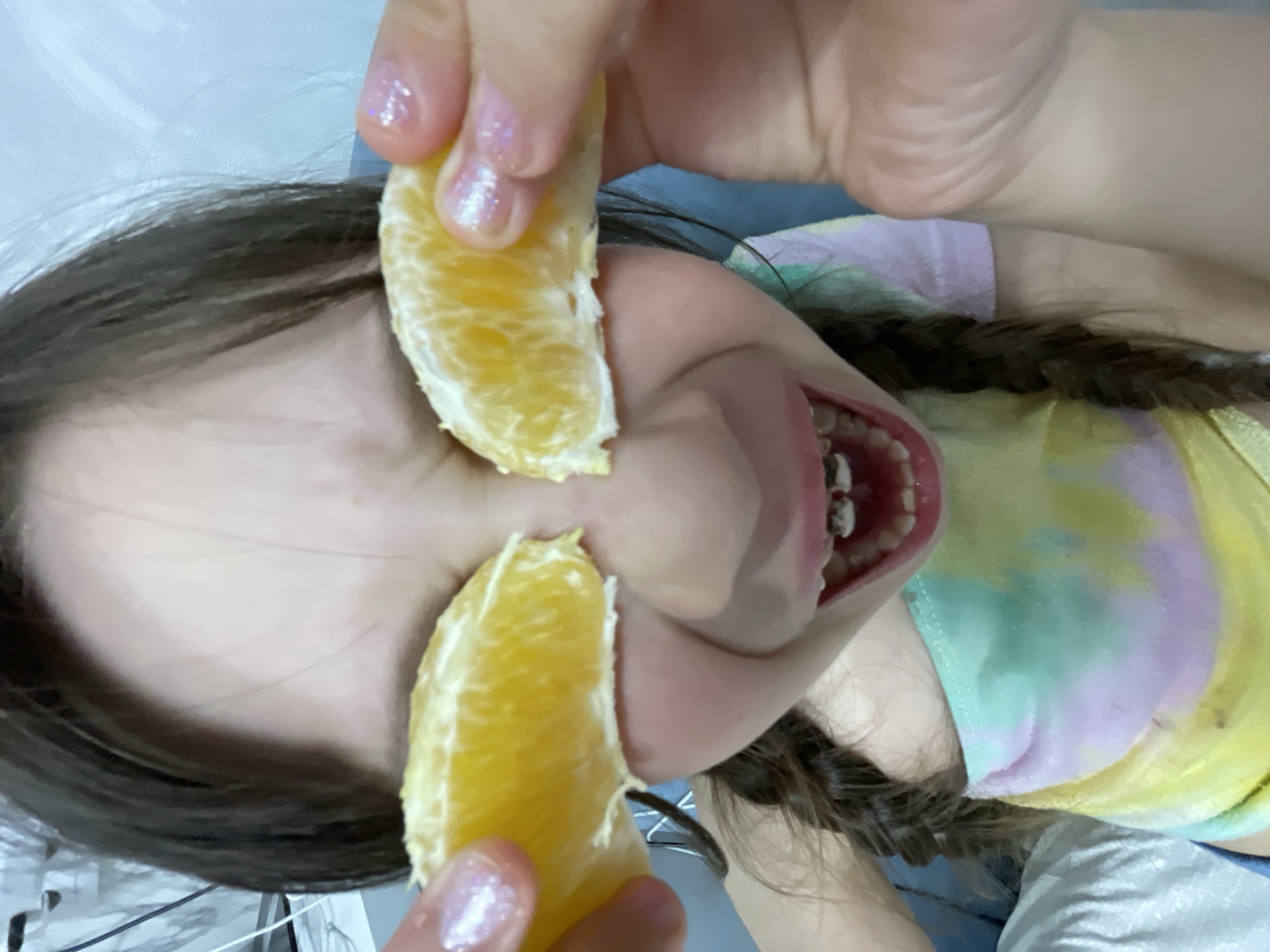 A young person is holding two orange segments near their face. One segment is being held near the forehead, and the other near the cheek. The person has braces. The person is wearing a tie-dye shirt and has braids in their hair. There are white cables visible in the lower left corner. The background is a pale blue. The photo's location cannot be determined from the visual information provided.