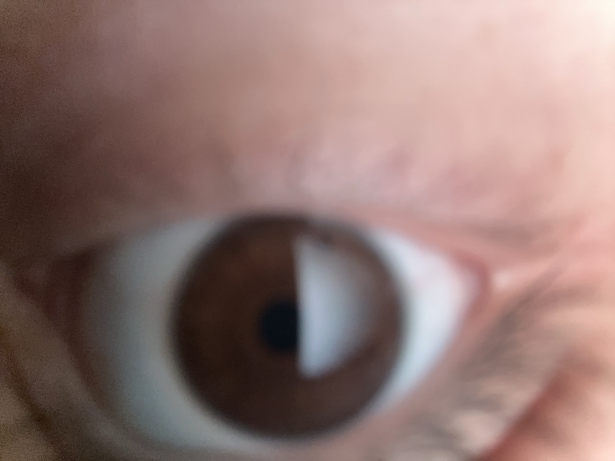 A blurry close-up image shows a brown eye. The location is not identifiable as Unknown, Unknown, or any specific location.