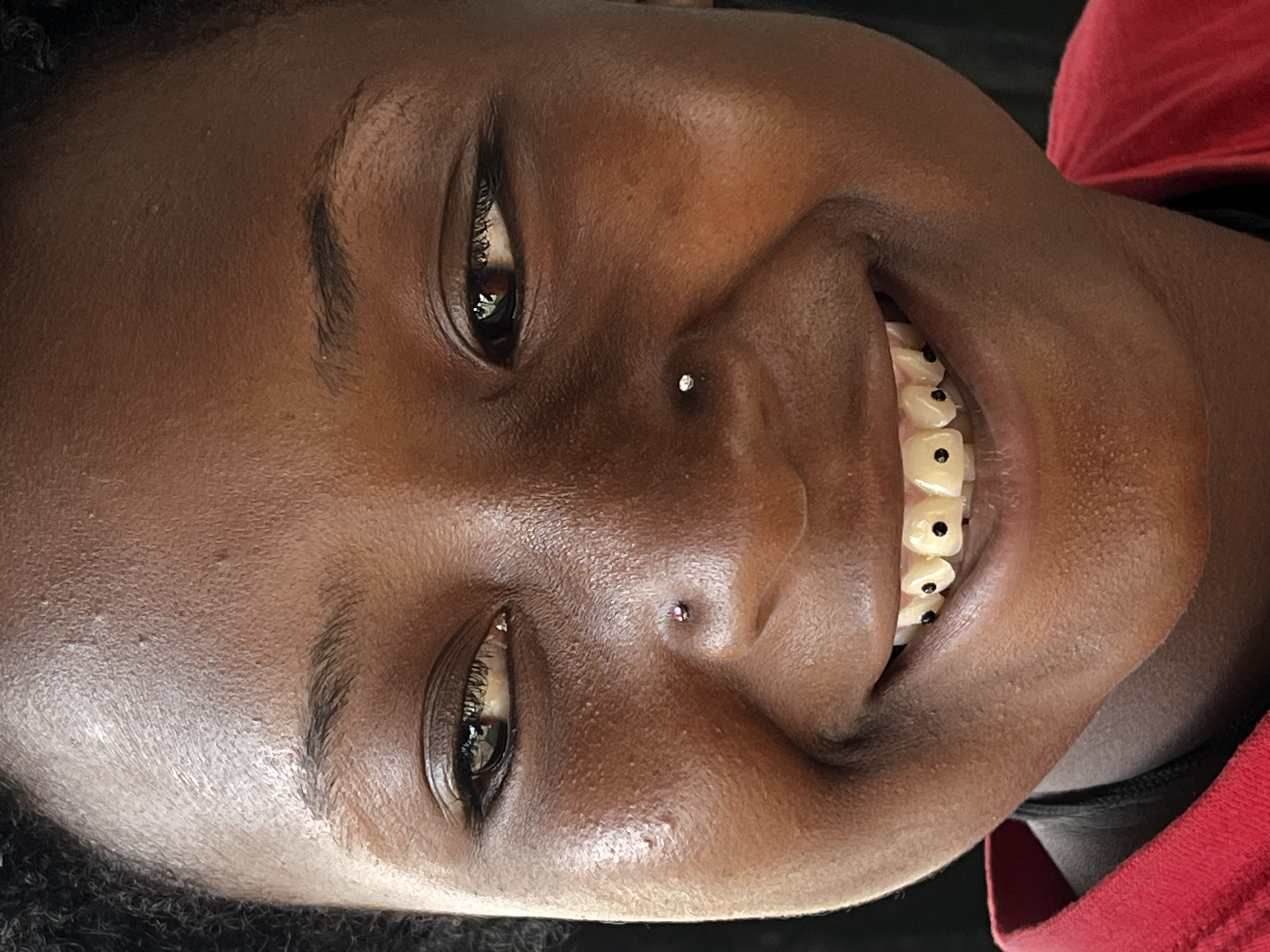 A close-up portrait captures a dark-skinned individual, likely female, tilted to the right, smiling widely and displaying teeth adorned with what appears to be black decorative elements. A small, possibly metallic, stud is visible in the left nostril. The subject's eyes are open and directed towards the viewer. Background elements are nondescript, only showing part of what seems like a red garment. No definitive information is discernible about the location in Barakin Akawo, Nigeria, or any actions or interactions.