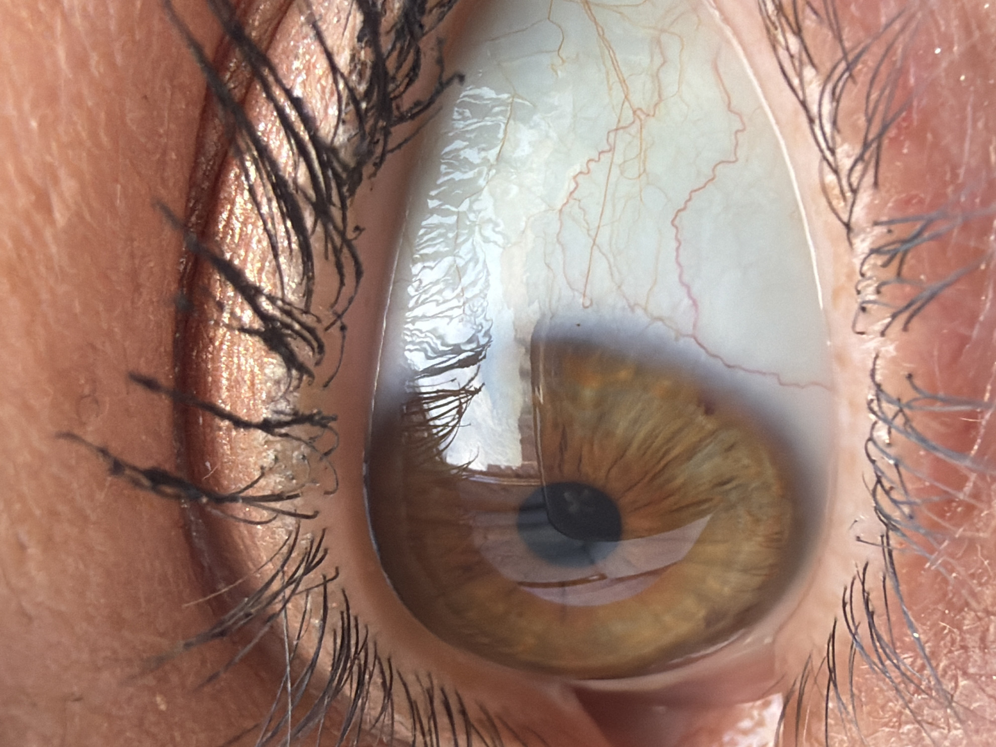 A close-up image of a human eye with a brown iris and a black pupil is presented. The sclera is visible, displaying red blood vessels. Eyelashes are present on both the upper and lower eyelids. A reflection is visible on the surface of the eye, but specific buildings or features cannot be discerned to identify the location in Saint Petersburg. No information is provided about people, actions, interactions, or the environment beyond what is immediately visible in the close-up image of the eye.