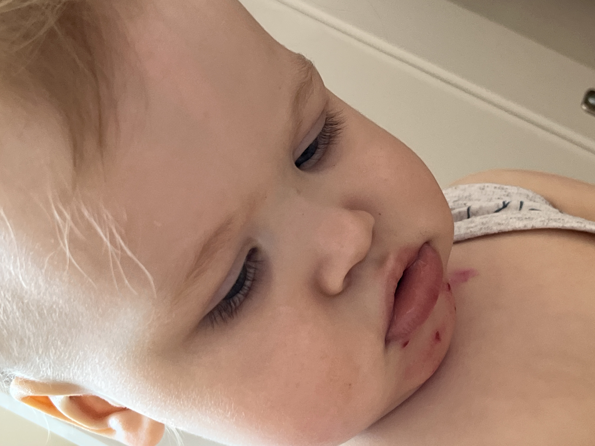 A close-up, high-angle shot depicts a fair-skinned child with blonde hair. The child's eyes are closed, suggesting sleep or rest. There is a noticeable abrasion or injury on the child's lip and adjacent skin, with traces of blood. The child is wearing a white tank top with a gray and black print. The background appears to be an interior setting, possibly a room with white walls. There is no information provided that indicates the location as Chaikovsky, Russia.