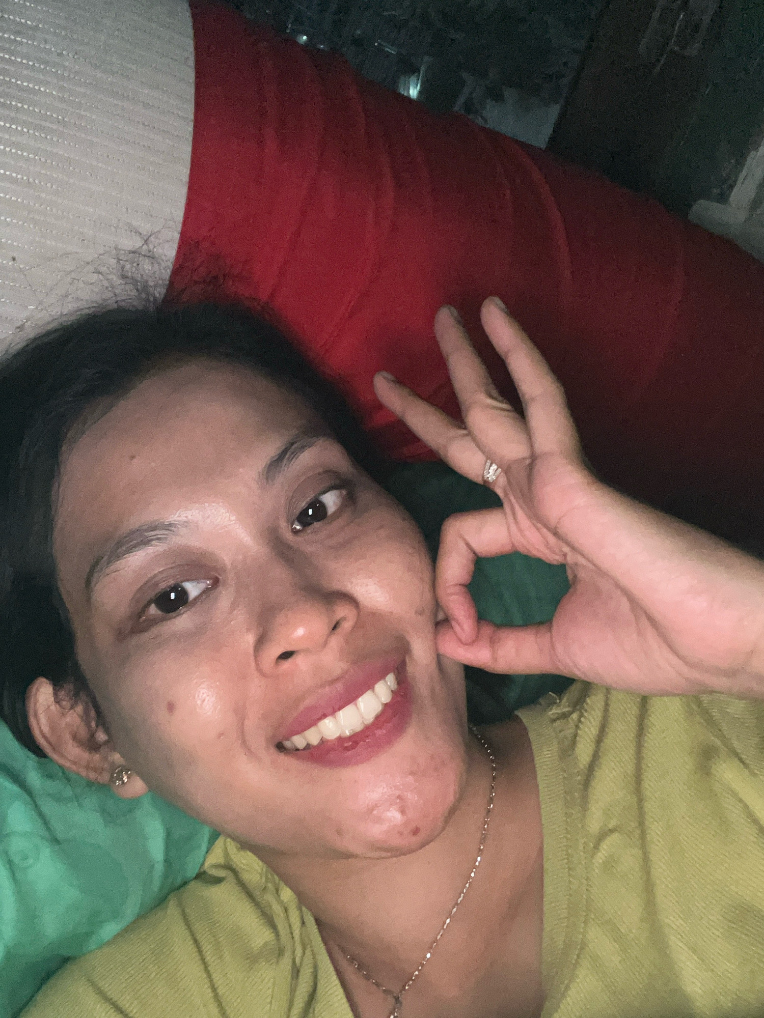 The image is a selfie of a young woman, possibly in her early twenties, lying down. She has dark hair, brown eyes, and fair skin with some blemishes. She is smiling and making an "okay" hand gesture. She is wearing a green shirt and a silver necklace. The background appears to be a bed with red and white pillows. The image is taken indoors, likely in a bedroom. There are no identifiable landmarks or details that would indicate a specific location within Kecamatan Pati, Indonesia.