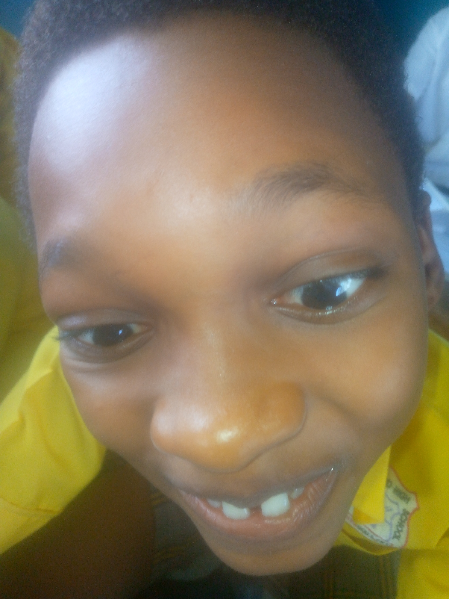 A close-up, slightly tilted, color photograph shows the face of a young person, likely a child, with brown skin and short, dark hair. The child has wide-set eyes, a broad nose, and an open mouth revealing several teeth, with a slight gap between the two front teeth. The child is wearing a yellow collared shirt, with a school emblem visible on the collar. The image was likely taken in Ikorodu, Nigeria.