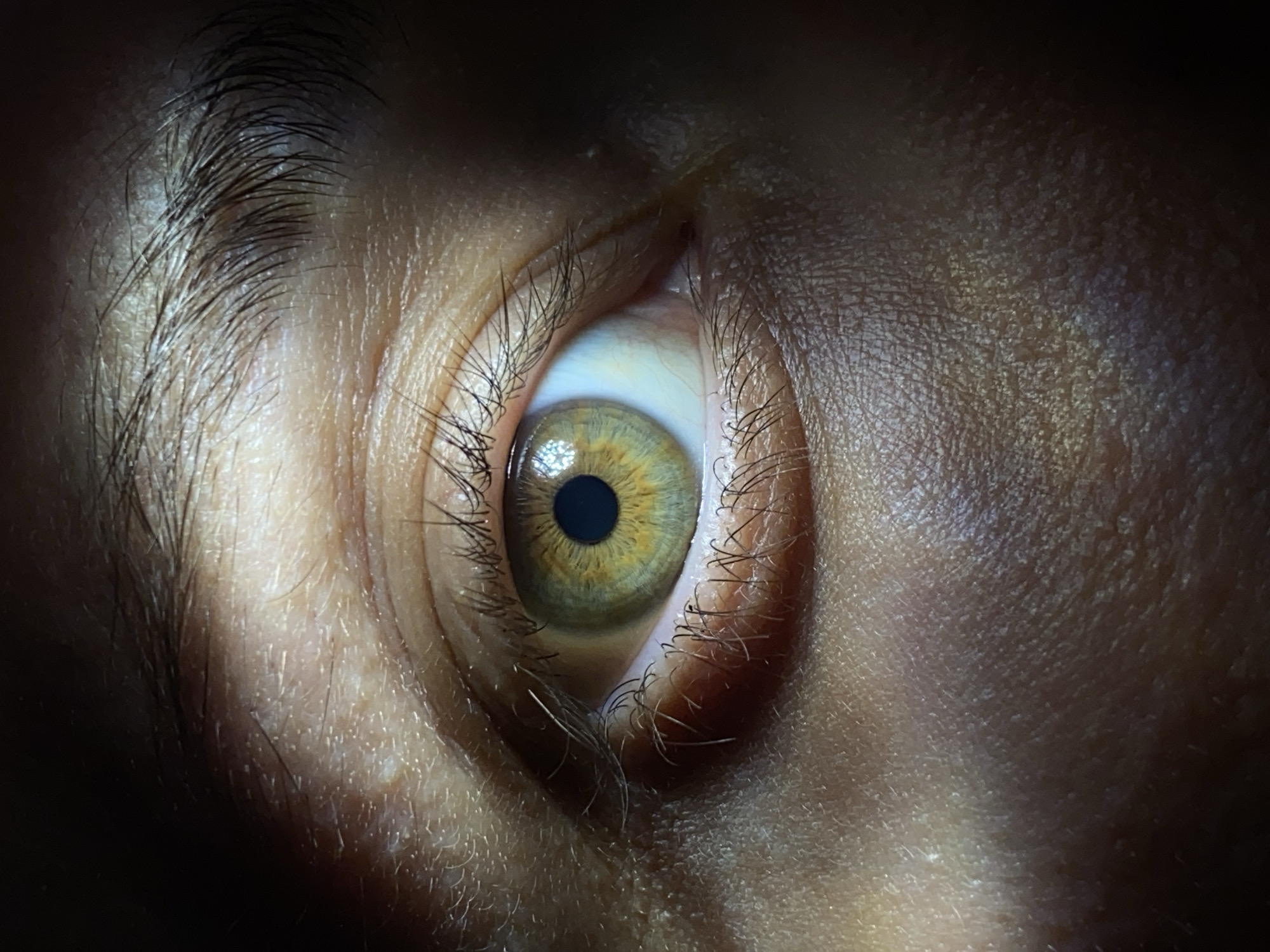 A close-up photograph shows a human eye with a light brown iris and a dark pupil. The skin surrounding the eye is pale with visible pores and fine hairs. Dark shadows dominate the edges of the frame, focusing attention on the illuminated eye. There is no indication of the city of Chaikovsky, Russia.