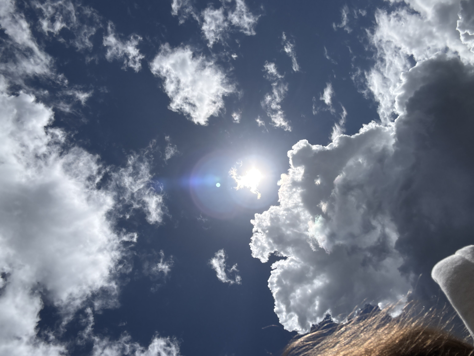The image shows a bright, sunny sky with scattered cumulus clouds. The sun is visible, partially obscured by a cloud, creating a lens flare. The sky is a deep blue color. In the lower right corner, a portion of human hair and a white fabric or garment are visible. No information is available in this image to indicate that the photo was taken in Moscow.