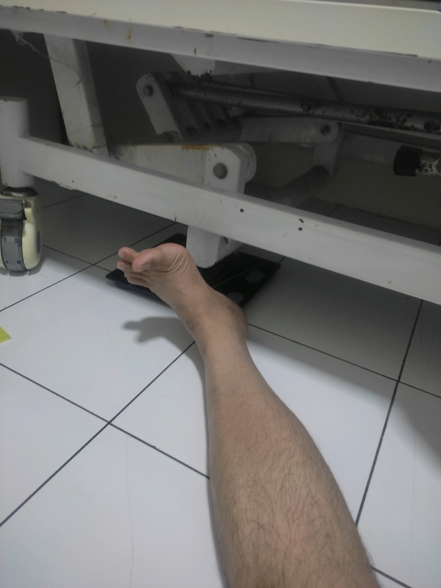 An adult's bare left leg and foot are visible, extended from beneath a white metal structure, likely a hospital bed frame. The leg is covered in light hair. The foot is bare and resting on a dark rectangular object, possibly a scale or a mat. The scene is set on a tiled floor with thin, dark grout lines. The metallic structure above shows signs of wear, with some rust and dark smudges. A white castor wheel, part of the structure, is visible on the left side of the frame. The lighting suggests an indoor environment, possibly a hospital room in Bogor, Indonesia.