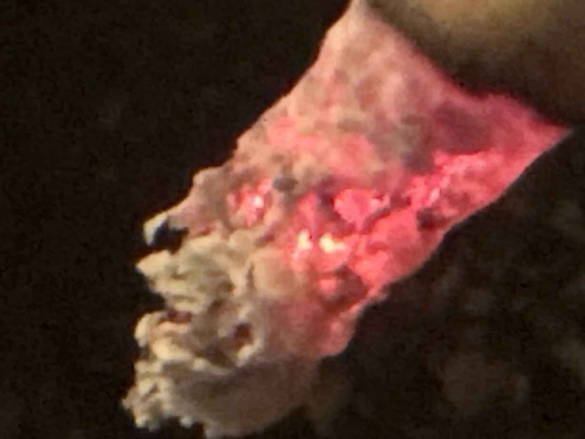 The image shows a close-up, blurry view of a light-colored, porous object with bright pink and red areas. The object appears to be illuminated from within or by a pink light source, causing some parts to glow. The texture of the object is irregular and somewhat lumpy. The background is dark and out of focus, suggesting a low-light environment. The overall impression is abstract due to the lack of clear context and the low resolution. Without more information, it is difficult to definitively identify the subject matter. It could be a piece of coral, a textured food item, a natural formation, or even an abstract art piece. The location context of Plovdiv, Bulgaria, does not provide any immediate clues to interpret the subject. There is no visible text in the image.