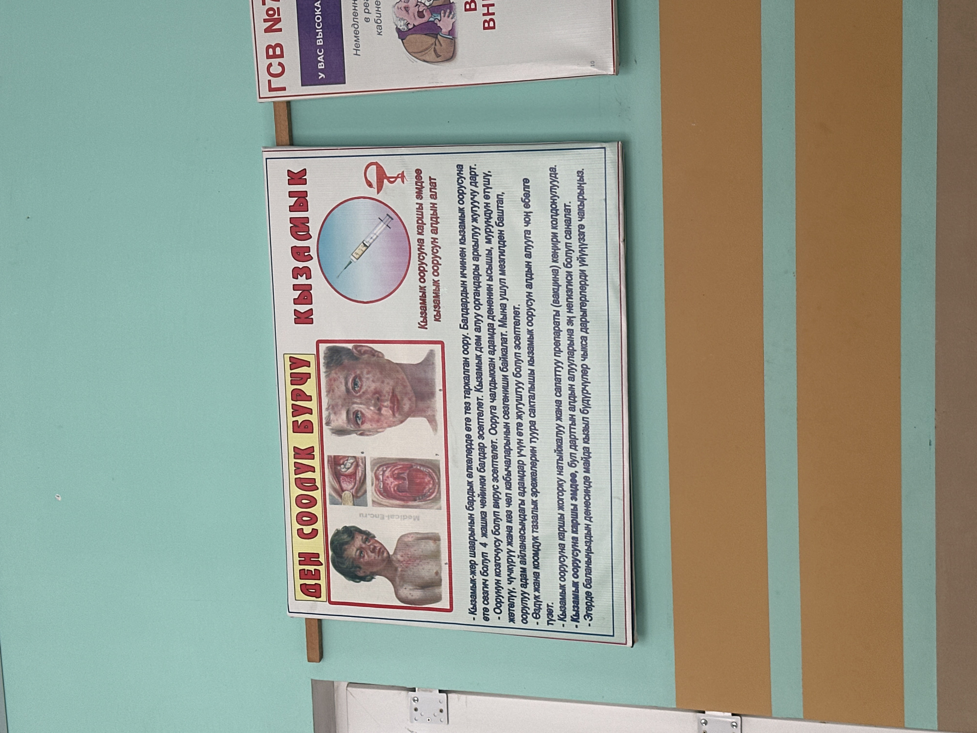 The image shows a bulletin board with two posters on a light blue and orange striped wall. The poster on the left is titled "ДЕН СООЛУК БУРЧУ" (Health Corner) and features illustrations of people exhibiting symptoms of measles ("КЫЗАМЫК"). It also includes an illustration of a syringe, likely representing vaccination. The text describes measles symptoms and emphasizes the importance of vaccination.
The poster on the right, partially visible, has text in Russian and appears to be a medical notice. It includes text like "ГСВ №" and "У ВАС ВЫСОКА" (You are highly welcome). Further text and an illustration suggest it might be related to immediate medical attention or a health facility.
The overall impression is an informational display in a healthcare setting, possibly a clinic or a community health center in Kyrgyzstan, aimed at educating the public about measles and general health awareness. The lighting suggests it is daytime.