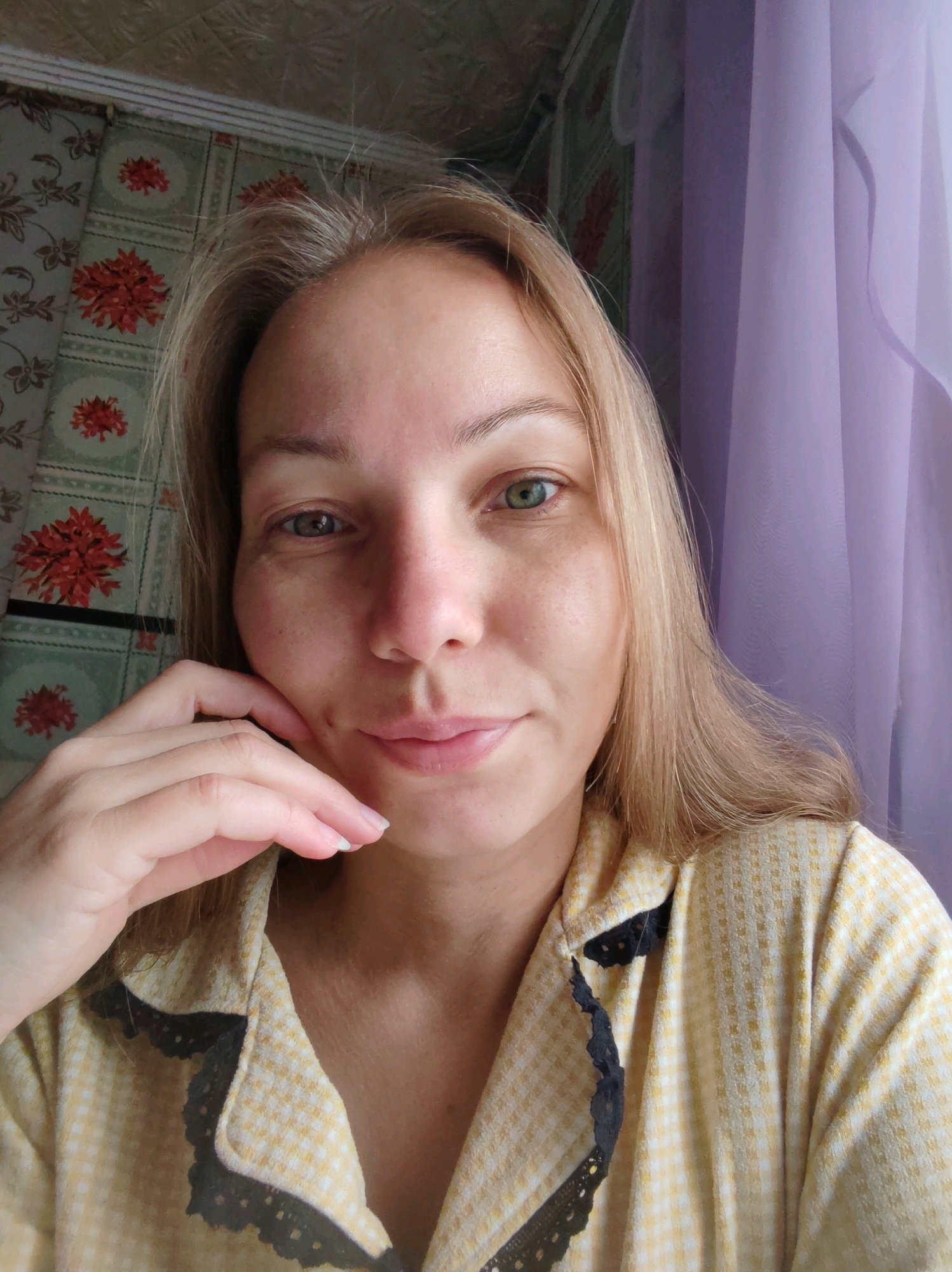 The image is a medium shot of a blonde woman, facing the camera directly. She has light skin with some freckles and areas of redness, particularly on her cheeks and forehead. Her eyes are a striking green, with one eye appearing slightly lighter than the other. Her lips are slightly parted, and she has a faint smile. Her right hand is raised, with her fingers gently resting against her chin and cheek. She is wearing a light yellow and white checkered pajama top with black lace trim along the collar and opening.
The background consists of patterned wallpaper with red floral designs on a light green base, and a sheer purple curtain on the right side of the frame. The lighting suggests it is daytime, possibly near a window. The image appears to be a selfie, taken indoors.
While the specific location within Чухлэм, Russia cannot be determined from the visual information alone, the domestic indoor setting is evident.