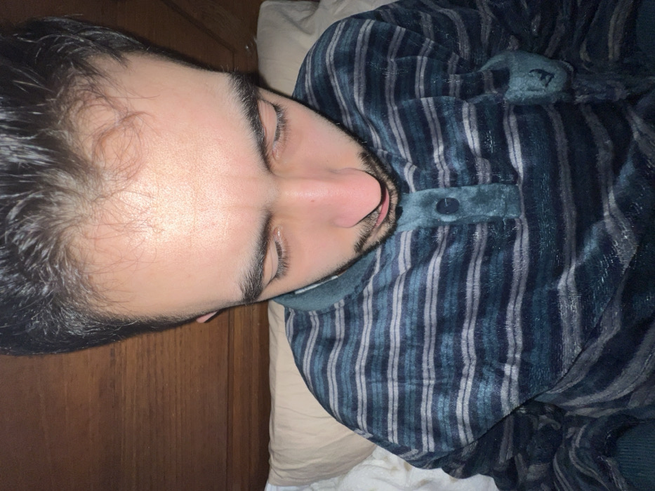 A person lies in bed wearing a striped velour top. Their face is tilted towards the camera with eyes closed. The person has dark hair and a trimmed beard. Part of a wooden door is visible on the left. The person rests on a tan pillow with white bedding visible underneath.