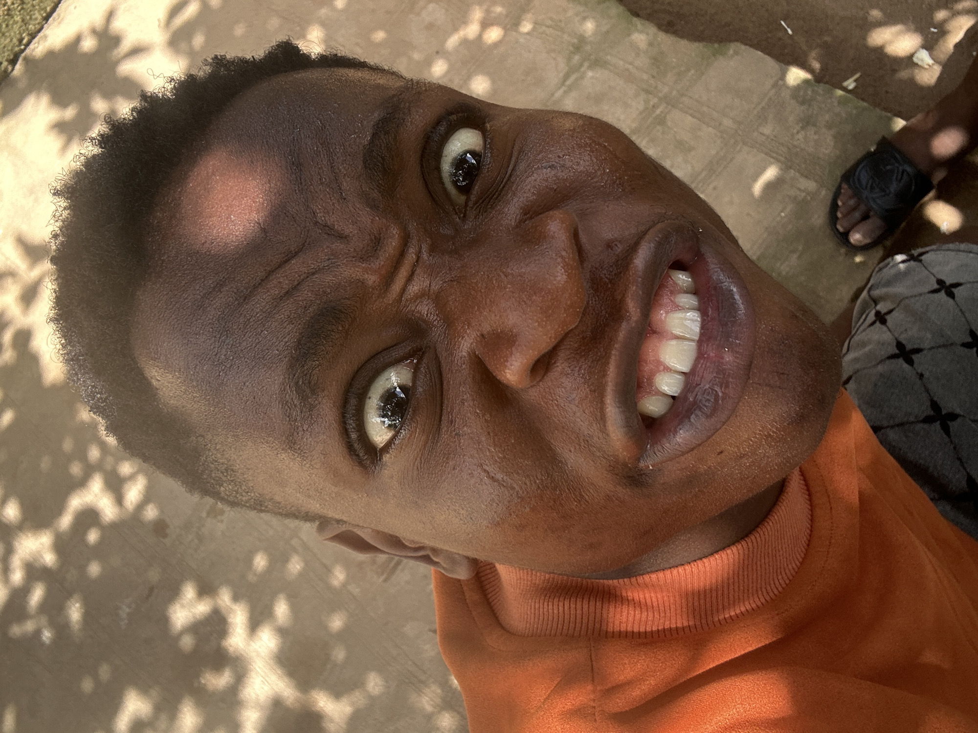 A close-up, tilted shot of a young, dark-skinned man's face. He is wearing an orange shirt. The man is making a distorted facial expression. The background is a textured surface, possibly concrete, dappled with shadows, and there is a foot in a sandal visible. The location is unknown.