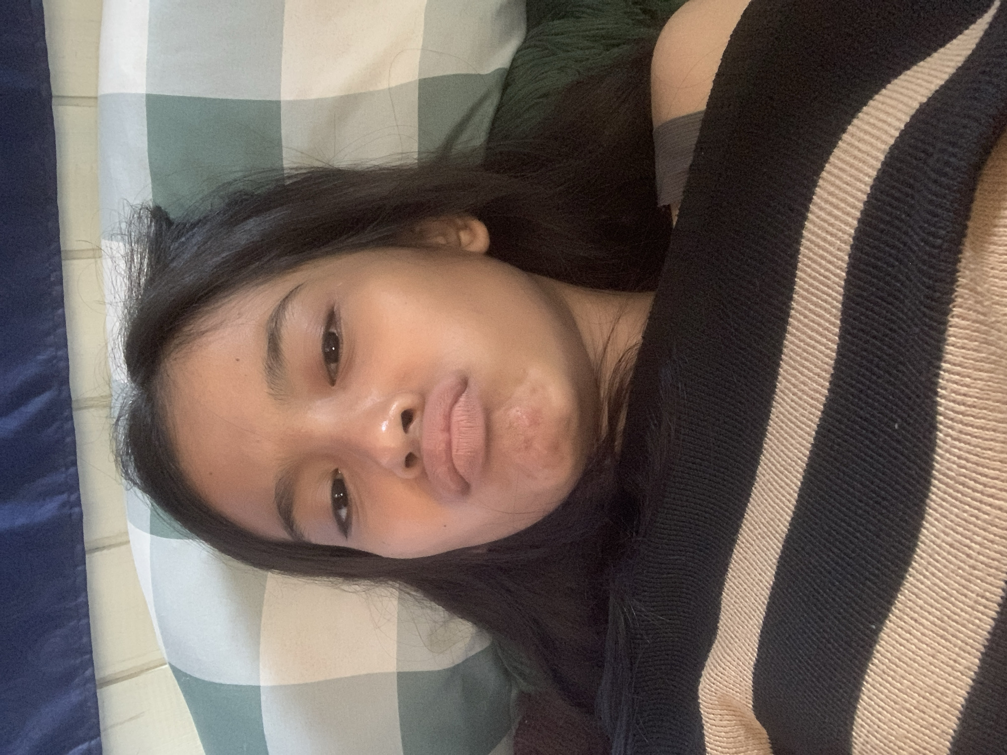 A young person, likely female, is depicted lying down indoors, resting their head on a green and white checkered pillow. Their long, dark hair is spread around their head. They have a light complexion and are looking directly at the camera with a distinct pout, lips pressed forward. Their face has a slight sheen, possibly from natural oils. The subject is partially covered by a black and beige striped fabric, which appears to be either a blanket or a piece of clothing like a sweater, with a grey sleeve visible beneath it. The background suggests an intimate setting, likely a bedroom, characterized by the pillow and dark green textured fabric. The time of day is not explicitly clear but implies an indoor, relaxed moment. There is no visible text in the image. The location context for this scene is Sungai Meriam, Indonesia.