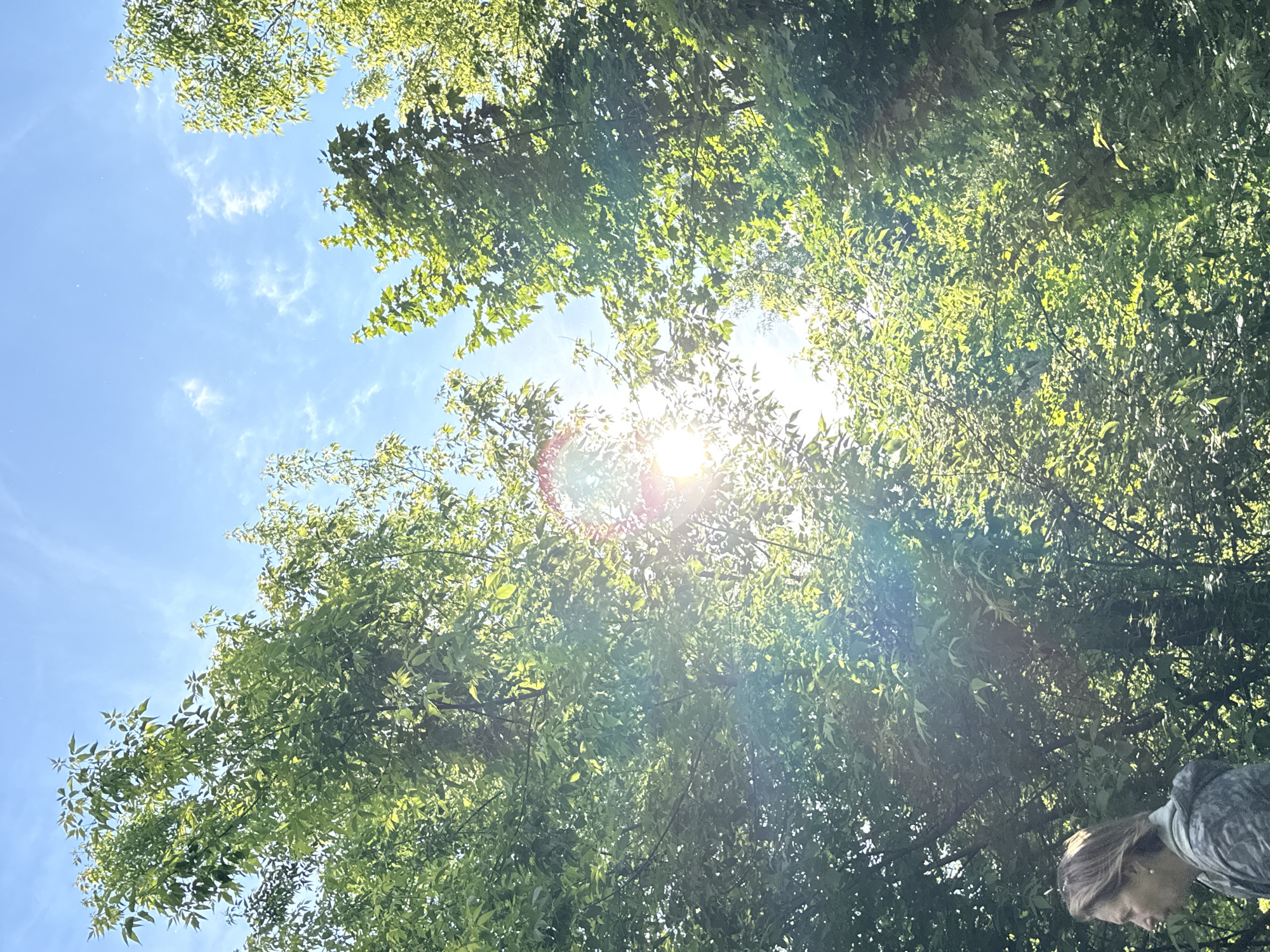 The image depicts a view upwards towards the sky, partially obscured by trees with lush green foliage. The sun is visible through the branches, creating a bright glare and lens flare effect. The sky is blue with scattered white clouds. In the bottom right corner of the image, part of a person's head and shoulder are visible, showing short hair, fair skin, and wearing what appears to be a gray patterned garment. It is impossible to confirm the location of the image as Moscow. The information provided in the request cannot be confirmed.