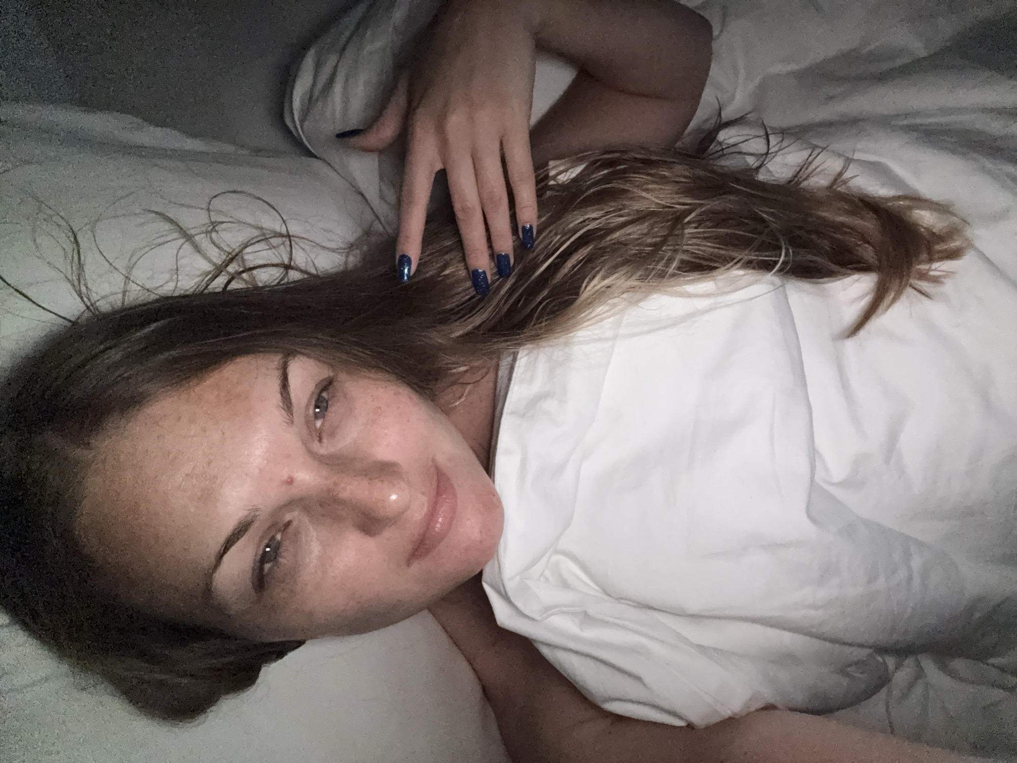 A woman lies in bed, her head turned towards the camera. Her hair is a medium brown, long, and appears to be wet, with some strands falling across her face. She has a light complexion with numerous freckles scattered across her cheeks and forehead. Her eyes are open, and she has a slight smile on her lips. She is wearing dark blue, glittery nail polish. Her body is partially covered by white bedding. The background is dark and indistinct, suggesting an indoor, likely bedroom environment. The lighting is dim, with a shadow cast on the right side of the image. The scene is devoid of any identifiable urban elements of Denpasar, Indonesia.