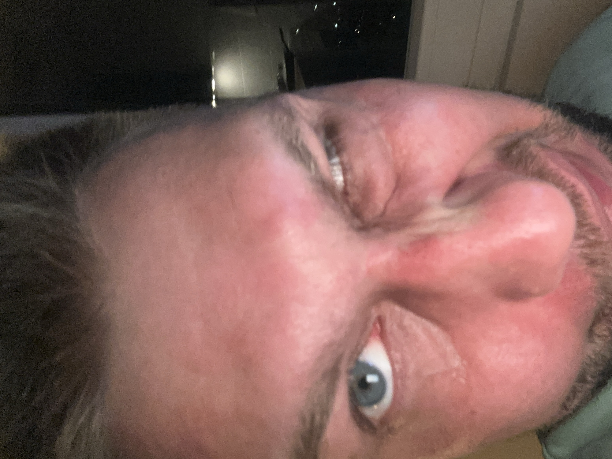 The image is a close-up, low-angle selfie of a fair-skinned male with visible facial hair and light brown hair. His left eye is open and light blue, while his right eye is partially closed in a wink. His skin appears flushed, with a reddish tone, particularly on his cheeks and around his nose. The background is dark and out of focus, showing what appears to be a window with some faint lights visible, suggesting an indoor setting at night. The overall impression is an informal, spontaneous self-portrait. Without further information or context, it is not possible to determine the specific location within Zvezdara Urban Municipality, Serbia.