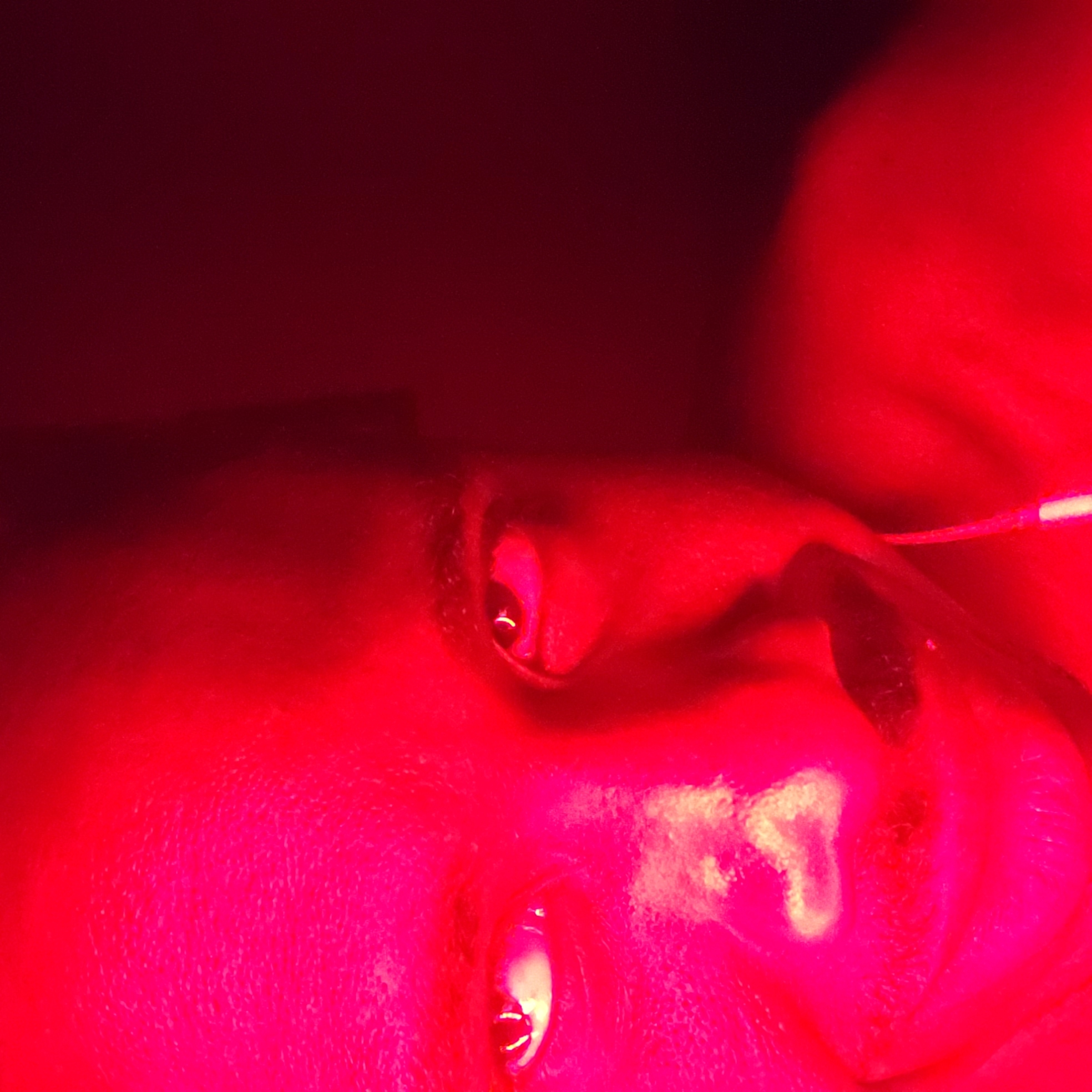 The image presents a close-up, highly illuminated view of what appears to be a person's facial features, primarily the eyes and surrounding skin, bathed in intense red light. Two distinct human eyes are visible: one positioned in the upper-middle part of the frame, partially open, and another towards the lower-center. Both pupils reflect bright light sources. The skin around the eyes is uniformly illuminated in vivid red and darker crimson tones.
To the right of the upper eye, a thin, light-colored tube or wire crosses the red-lit surface. Near the lower eye, an irregular white patch, possibly a topical substance or residue, is evident on the skin. The pervasive red coloration throughout the image suggests the use of specialized lighting, likely in a medical or clinical setting, possibly for an examination or treatment involving the eyes. Due to the artificial lighting, natural skin tones are not visible, and no specific location cues, time of day, or emotions can be discerned. There is no visible text.