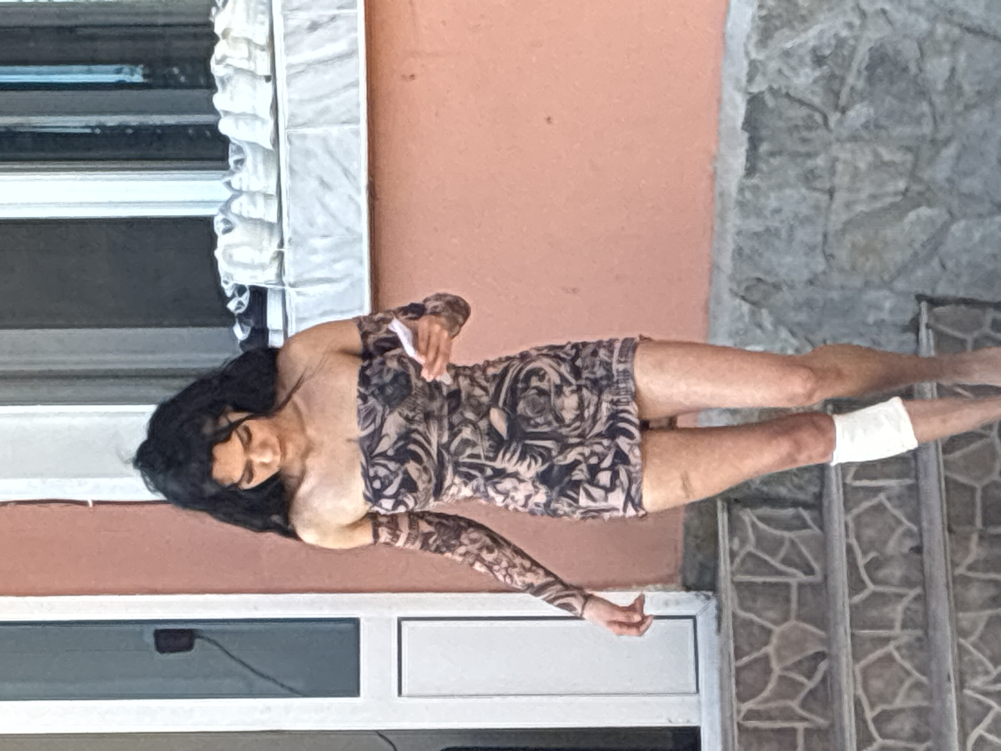A young woman with long, dark, wavy hair is depicted walking down a set of outdoor steps in Radievo, Bulgaria, during daylight hours. She is wearing a strapless, short dress with detached long sleeves, both featuring an intricate dark pattern on a lighter background. Her head is tilted downwards, and she is looking at a white smartphone held in her left hand. Her right knee is wrapped with a white bandage, and minor abrasions are visible on both legs. The background consists of a building with a peach-colored exterior wall. To the woman's left, a white-framed glass door or tall window is visible. To her right, a white-framed window is present, beneath which a ledge holds several white objects, possibly shoes. The steps are constructed from grey, irregularly shaped stone tiles, and a lower wall of rough, grey stones is visible at the bottom right.
