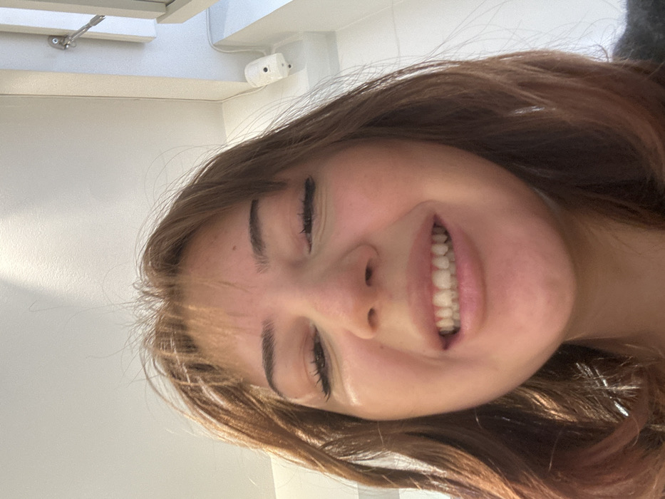 The scene is set indoors in the city of Strasbourg, France. A young adult female is depicted in a close-up, low-angle view, looking towards the camera with a strained smile or grimace, revealing her upper and lower teeth. She has medium-brown hair with bangs, appearing slightly disheveled, with some reddish highlights. Her eyes are partially closed or squinting, with visible eyelashes and dark eyebrows. A dark garment is visible on her lower right side. The background consists of white interior walls. On the upper right, a white wall-mounted security camera with two visible lens or sensor points is present, from which a white cable extends upwards. Adjacent to the camera, a portion of a white window frame with a silver-colored window stay mechanism is visible. A strong light source from above and to the left casts a distinct shadow line on the upper left wall.