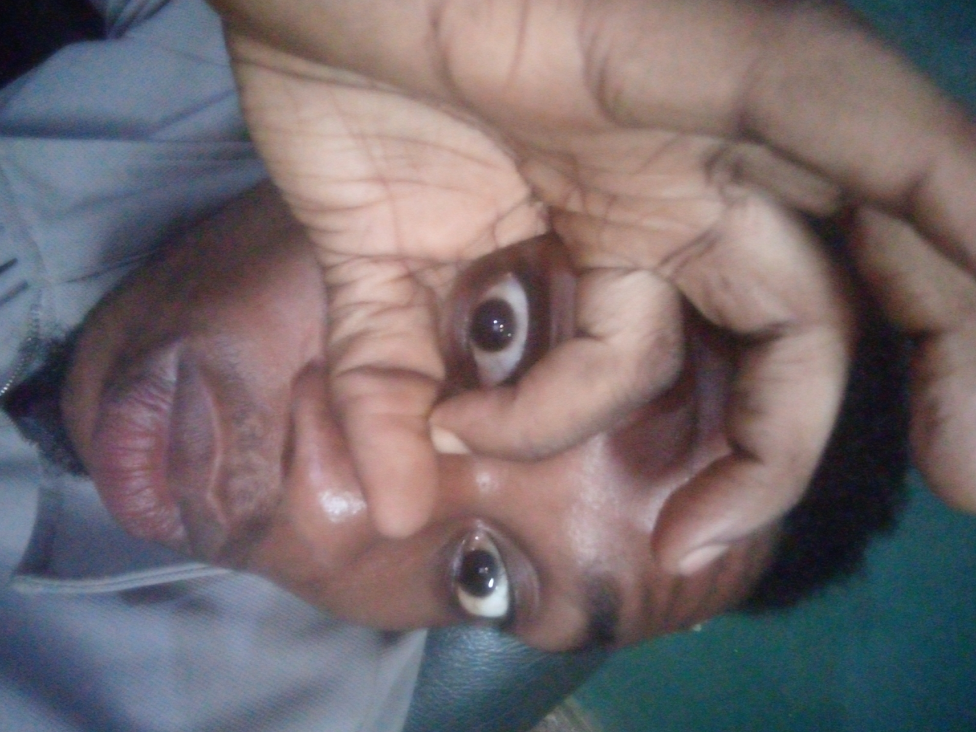 A close-up, upside-down view shows a dark-skinned person lying on their back with a hand covering the upper part of their face, leaving both eyes visible. One eye is being stretched open by a finger. The person has dark hair and appears to be wearing a light grey shirt. The background appears to be a green surface. The location is Unknown, Unknown.