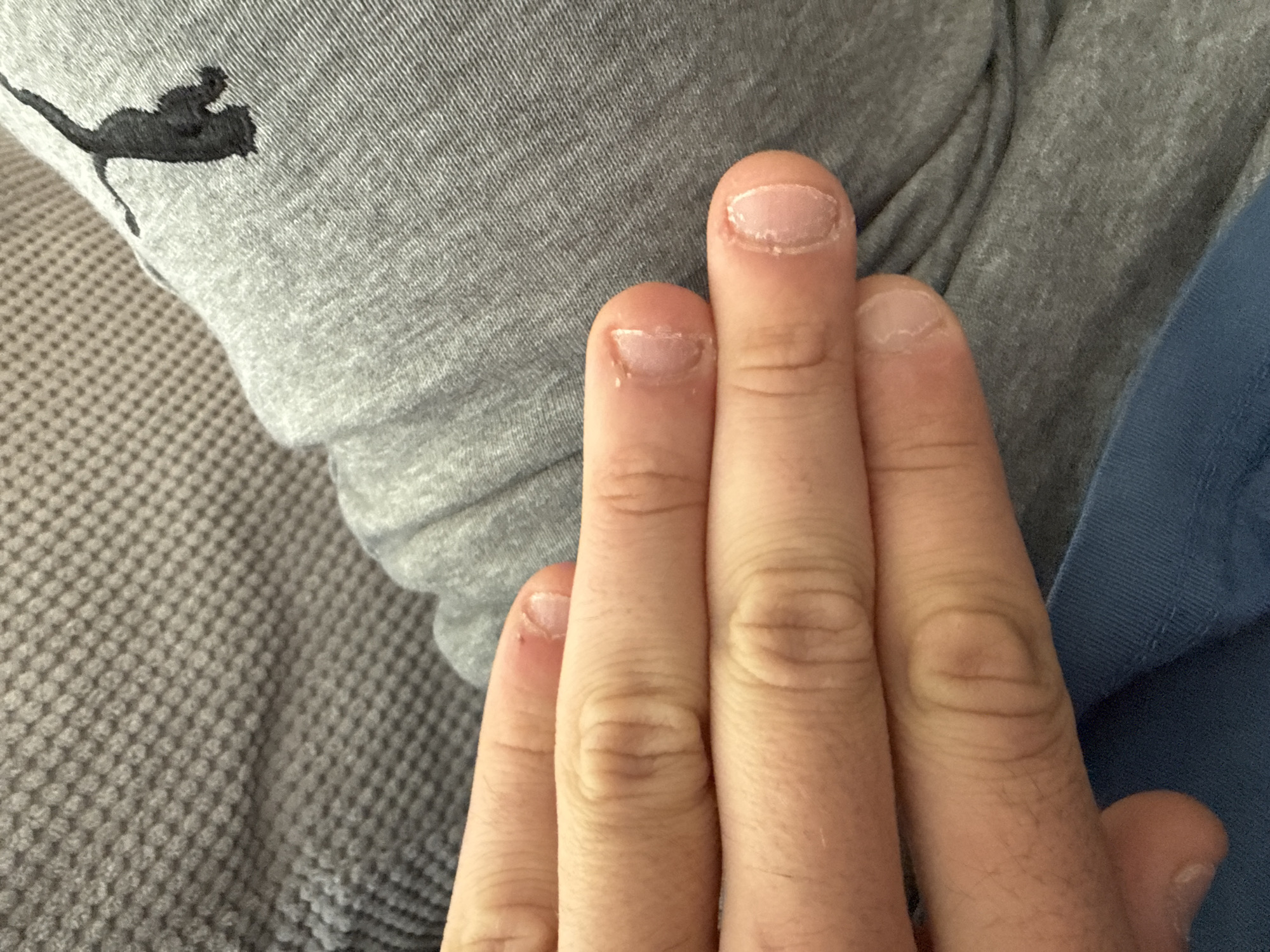 A close-up image shows four fingers of a hand, with the fingernails bitten short. The hand rests against a light grey garment with a small, dark logo of a person on horseback. To the left is a grey waffle-textured surface, and to the right, a piece of blue fabric is visible. The location is unknown and is not discernable from this image.
