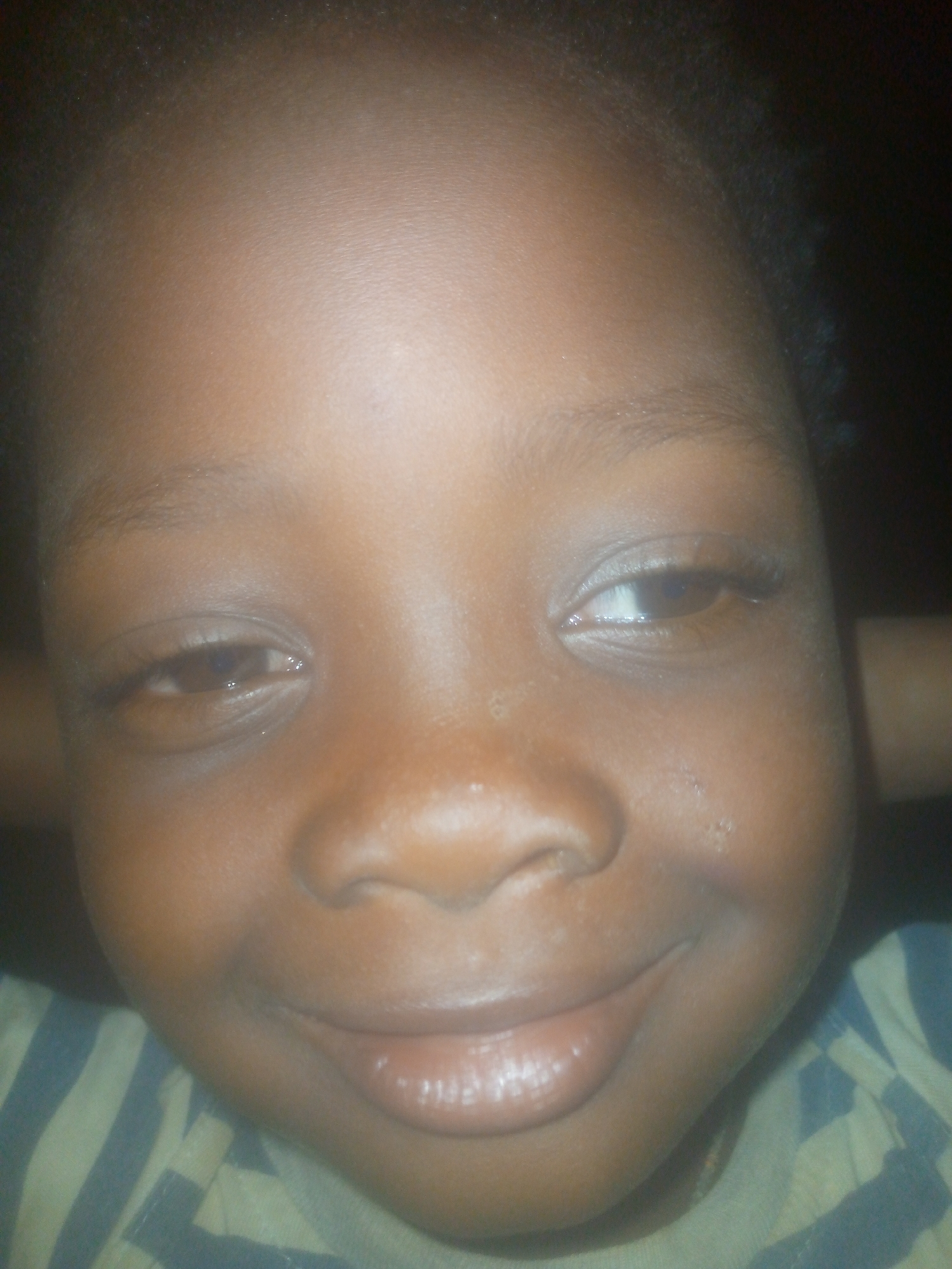 A close-up portrait features a young child with a dark skin tone, whose face fills the majority of the frame. The child looks towards the viewer with a gentle, faint smile, exhibiting a calm and perhaps slightly shy expression. Their full lips are closed in the smile and appear moisturized, without teeth visible.
The child's eyes are dark brown. The left eye looks relatively forward, while the right eye is averted to the side, showing more of the sclera on the inner corner. Dark eyelashes are visible framing both eyes. The skin of the face is illuminated, possibly by a soft, diffused light source, highlighting some texture and subtle reflections.
The top of the child's head shows dark, possibly short and curly hair, blending into a very dark, indistinct background that suggests an indoor or dimly lit environment. At the bottom of the frame, a striped garment with alternating dark and light (likely blue/black and light yellow/beige) bands is visible, worn by the child around the neck and shoulders. No specific location cues are discernible, and there is no visible text in the image.