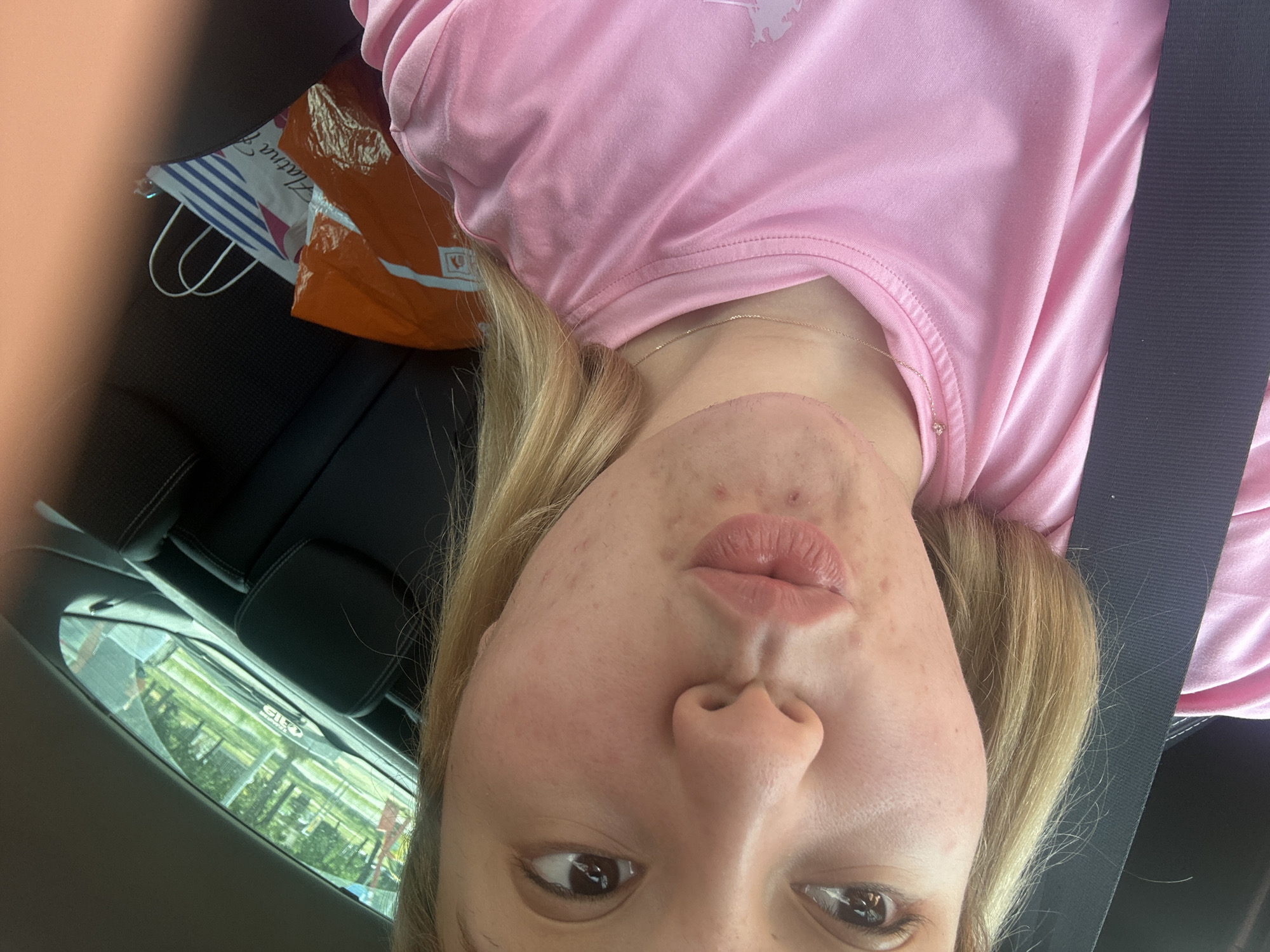 The image shows a young woman in a car. She is wearing a pink t-shirt and has blonde hair. Her face is partially visible, and she appears to have acne. There are shopping bags in the background, one orange and one with blue and white stripes. The car appears to be parked or stopped, with greenery visible through the window. The image is taken from a low angle, and the woman's face is upside down. The overall impression is of a casual, everyday moment. There is no discernible time of day or weather information. Text is visible on the orange shopping bag, but it is not legible.