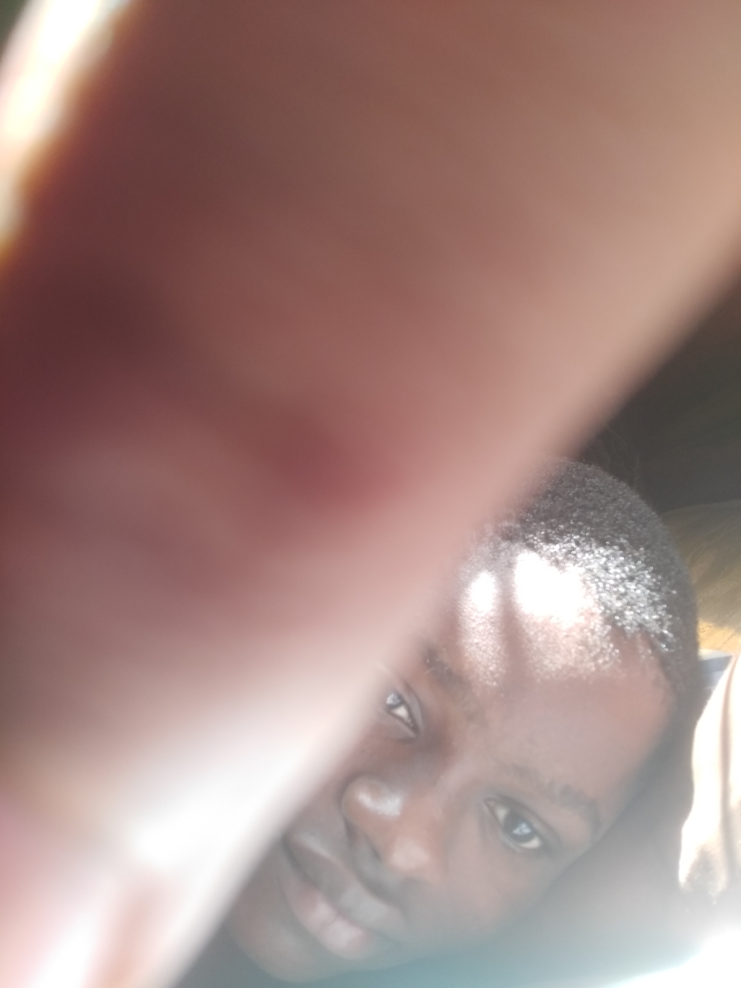 This close-up portrait features a person with dark skin and short, dark hair, looking directly at the camera. A large, blurred hand, likely the photographer's or subject's, dominates the foreground, obscuring the upper left and central parts of the image. The person's face is visible in the lower right portion of the frame, illuminated by bright, strong light that creates highlights on their forehead and cheek. This intense lighting also causes significant lens flare and overexposure, particularly across the hand and the top-left area. The overall brightness suggests it is daytime. The person's expression appears neutral. The composition, with the hand so close to the lens and the direct gaze, indicates this is likely a selfie or a very intimate close-up shot. No specific background details or text are discernible, offering no visual clues to pinpoint the exact location within Shangisha, Nigeria.