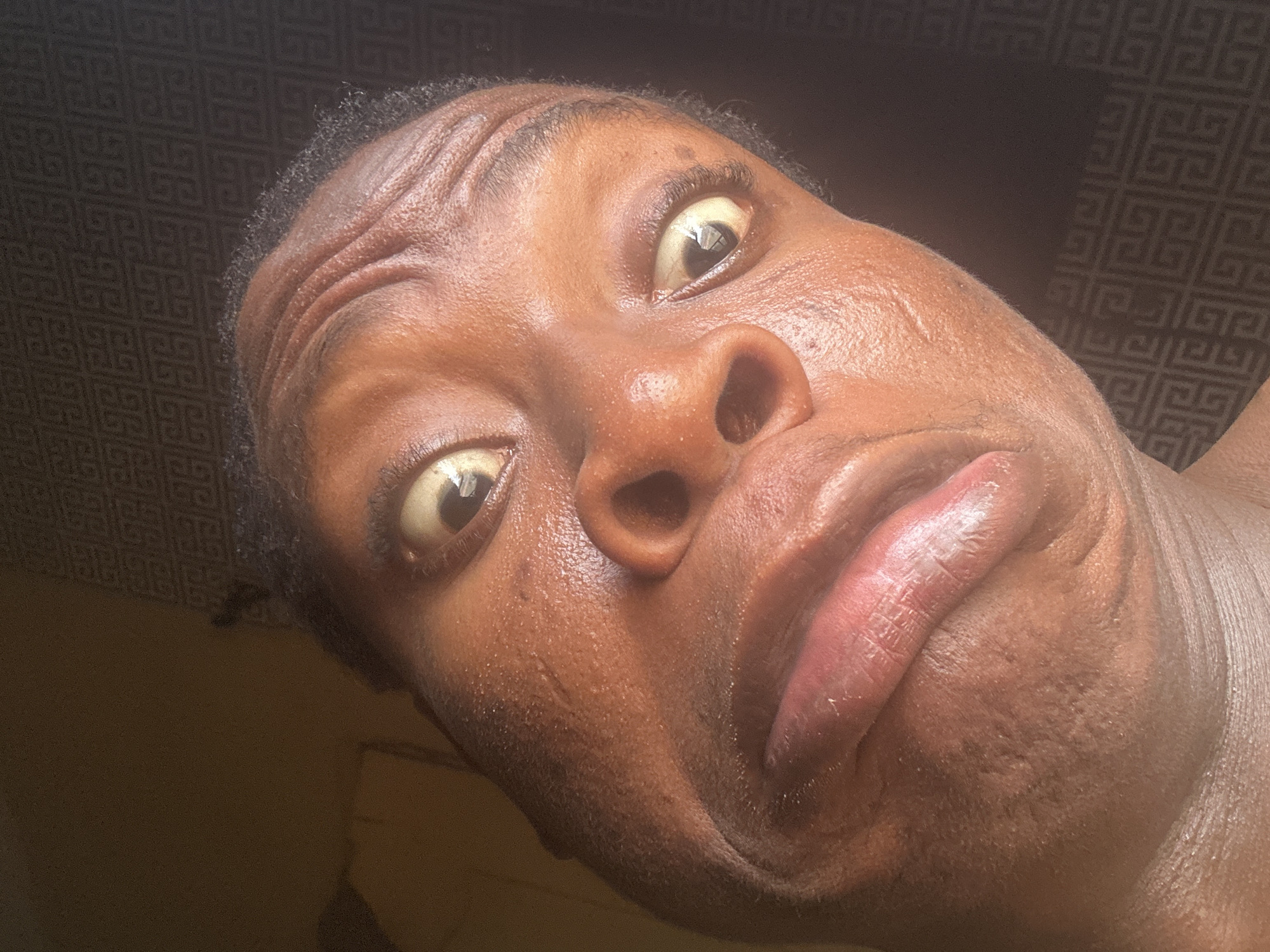 A close-up, low-angle shot of a person's face, possibly male, with dark skin. The person's expression appears exaggerated, with raised eyebrows and slightly widened eyes. The skin is shiny, potentially due to oil or sweat. Wrinkles are visible on the forehead. The background is blurred, but appears to be a patterned surface. The location is Unknown, Unknown.