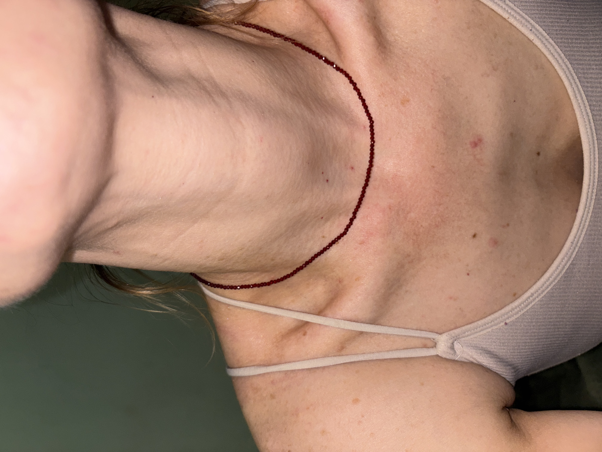 The image shows a close-up of a person's neck, collarbone, and upper chest. A thin, dark red beaded necklace is worn around the neck. The skin has visible pores, freckles, and some small red blemishes. The person is wearing a light-colored tank top with thin straps. The background is a dark, muted green color. No specific location in the city of Unknown, Russia is discernible from the image.