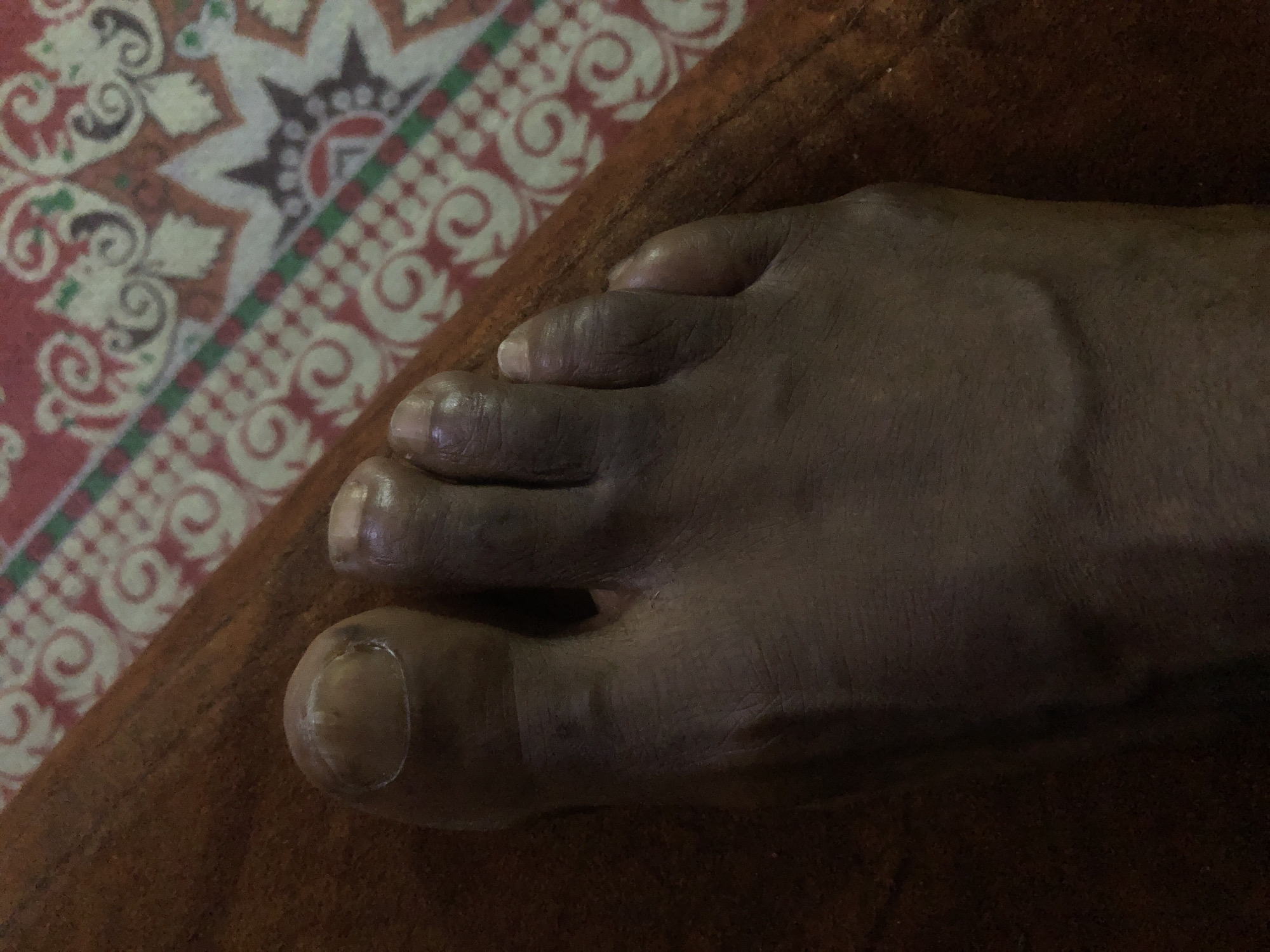 The image is a close-up, overhead view of a person's foot, resting on a textured brown surface. The foot is dark-skinned, with five toes visible. The toenails are light in color and appear somewhat unkempt. The background features a patterned textile with red, white, green, and black elements, suggesting a decorative rug or cloth. The lighting is dim, casting shadows that highlight the contours of the foot and toes. There is no indication of the specific location within the city of Kabong, Nigeria, or any contextual details about the scene beyond what is visually present.