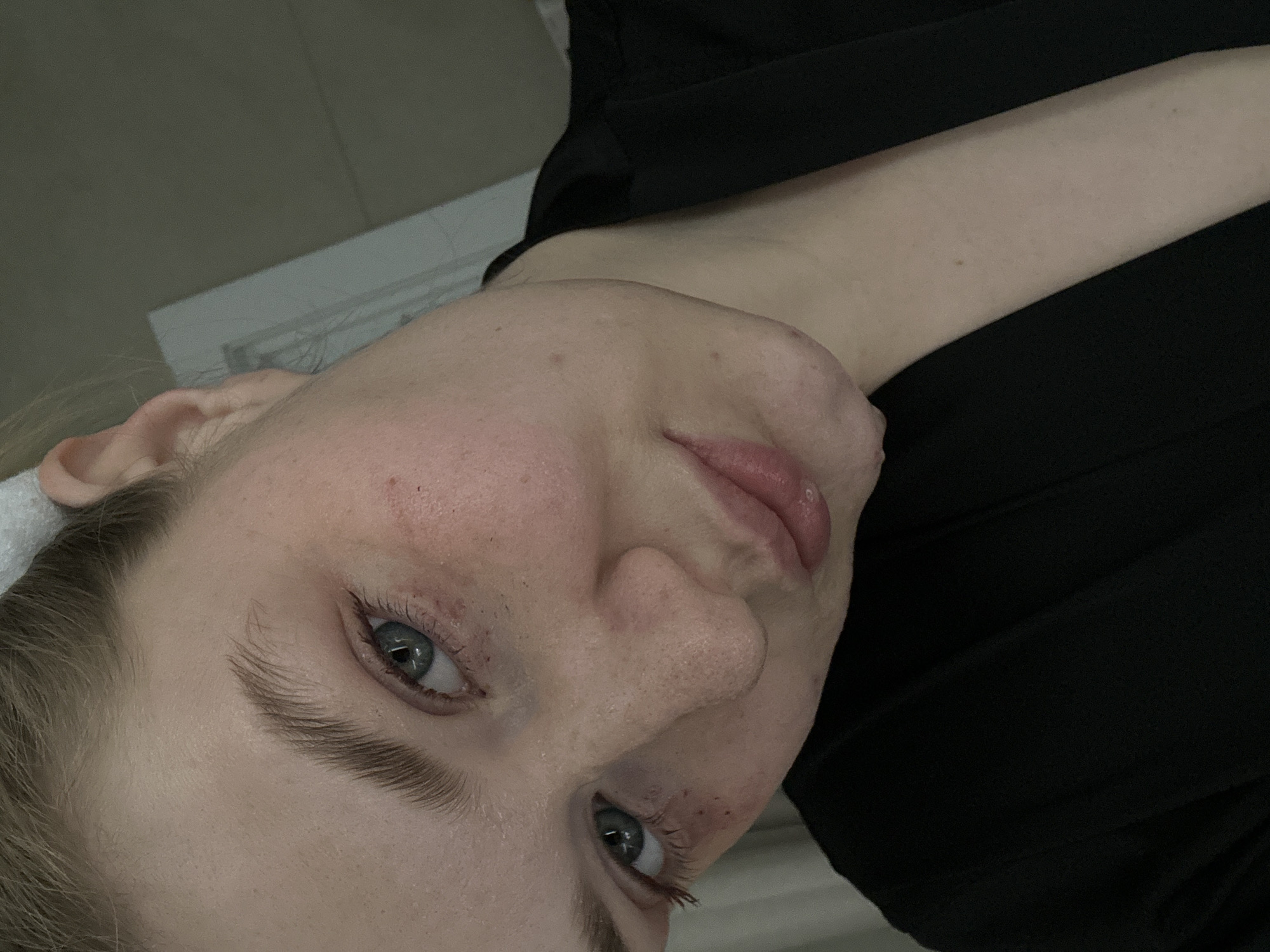 The image displays a close-up, angled portrait of a fair-skinned individual in an indoor setting located in Kazan, Russia. The subject has light blue-grey irises, medium brown eyebrows, and light-colored hair pulled back, with a white hair accessory or towel visible at the top of the head. Multiple red marks, consistent with petechiae or minor skin irritation, are present on the facial skin, particularly beneath both eyes. The individual's lips are full. They are wearing a black garment, possibly a robe or top, with a visible collar line. The background is an out-of-focus interior, featuring a plain, darker wall with a light-colored, rectangular architectural element (possibly a door frame) positioned on the upper right side of the frame. The subject's head is tilted, and their gaze is directed towards the camera.