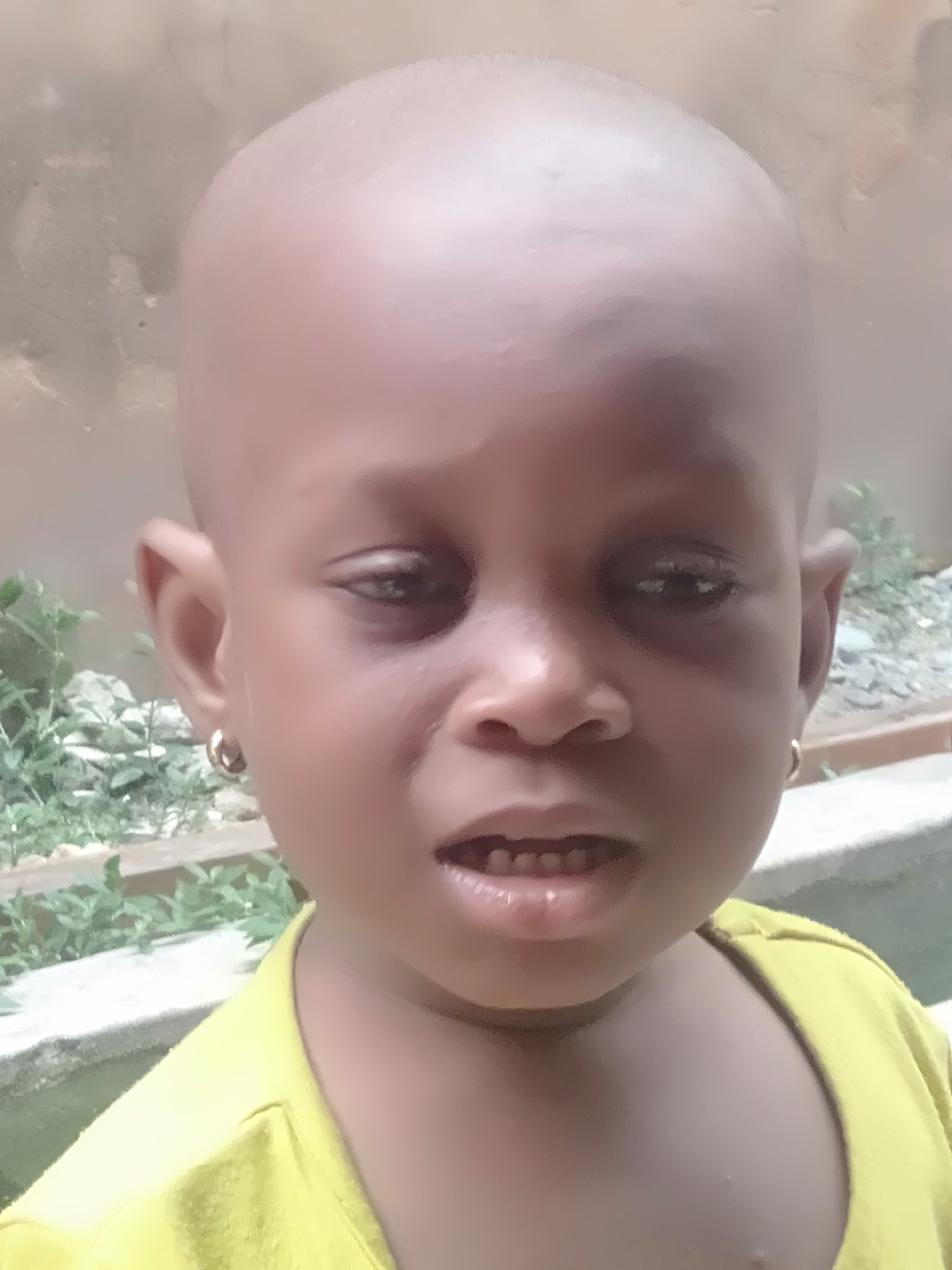A close-up, head-and-shoulders portrait features a young child with dark skin and a shaved head, looking directly at the camera. The child has dark eyes, slightly downcast, and their mouth is slightly open, revealing small teeth. They are wearing gold hoop earrings in both ears. The child is dressed in a bright yellow t-shirt, visible on their shoulders and chest.
The background is softly blurred, indicating an outdoor setting during the daytime with bright, possibly sunny, conditions. On the left side of the frame, out-of-focus green foliage suggests bushes or plants. On the right, there is a light-colored, textured surface, possibly a wall or concrete structure, with some darker patches and what might be light-colored debris or rocks towards the bottom. The overall impression is a casual, outdoor snapshot. The child's expression is neutral or slightly contemplative. The location is Shangisha, Nigeria.