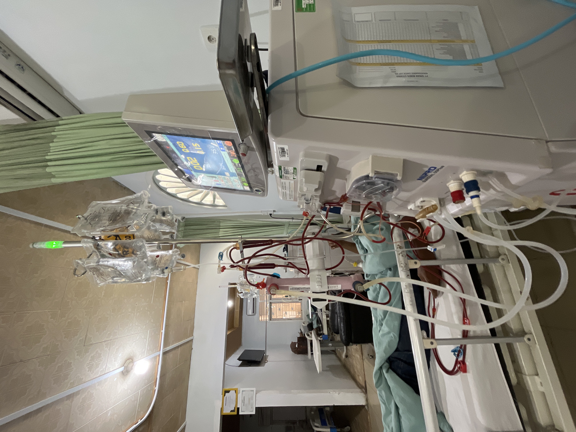 The image depicts a medical setting, likely a hospital room, in Lhokseumawe, Indonesia. In the foreground, a dialysis machine is prominent, with numerous red and clear tubes connecting to a patient lying on a hospital bed. The patient is partially covered by a light blue sheet. Above the machine, an IV pole holds several bags of intravenous fluid, one of which is illuminated by a green light. The room features medical equipment, including the dialysis machine, a patient bed, and an IV pole. The walls are painted white, and green curtains are visible in the background. A ceiling fan and lights are also present. A monitor screen on the dialysis machine displays medical readings. The overall scene suggests a patient undergoing dialysis treatment.