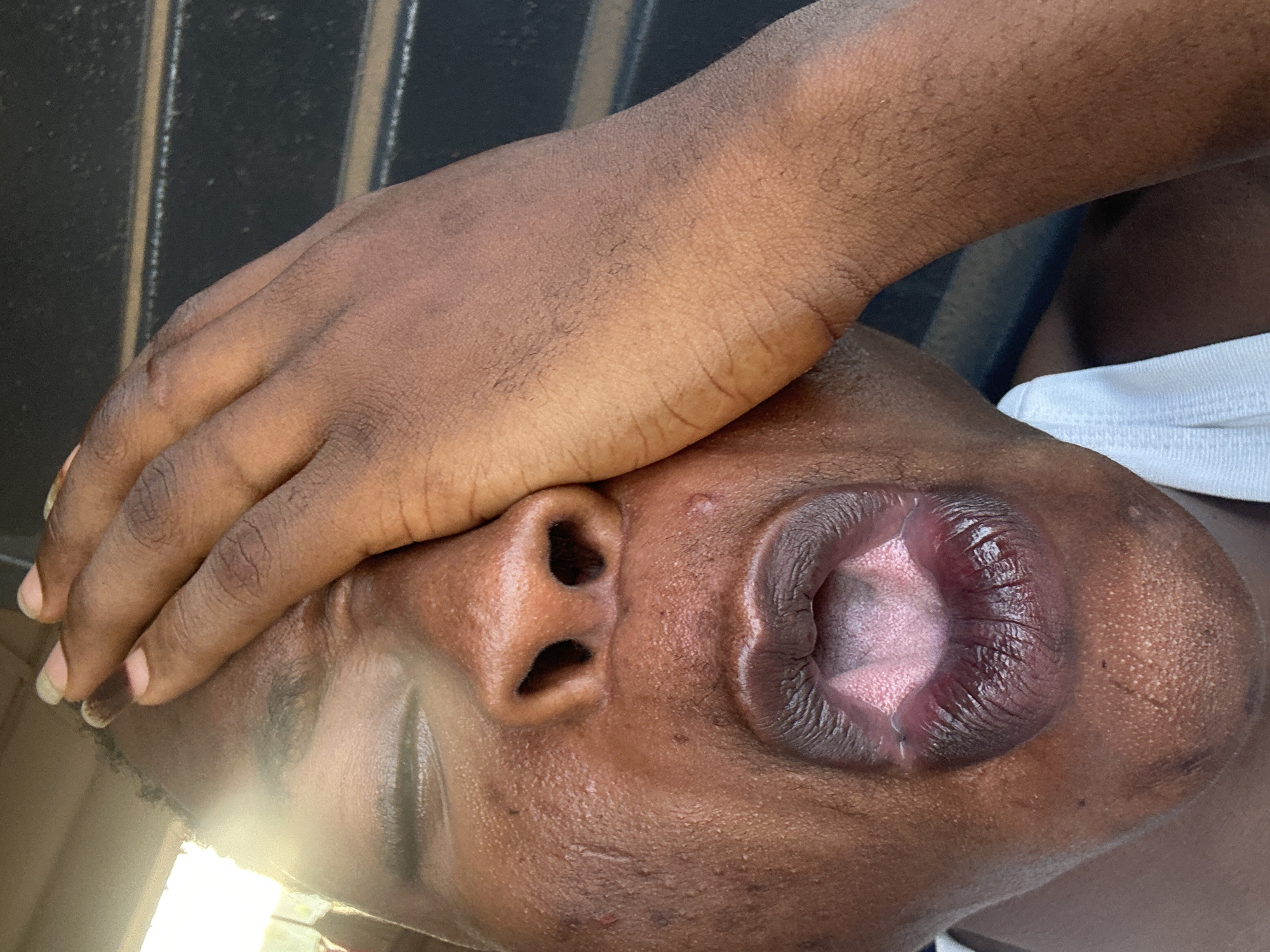 A close-up, angled shot shows the face of a person with dark skin partially obscured by their own hand. The person's lips are open, and the inside of their mouth is visible. Their eyes are closed. The background includes what appears to be a dark surface with light lines. A white shirt collar is also visible. The location is Unknown, Unknown.