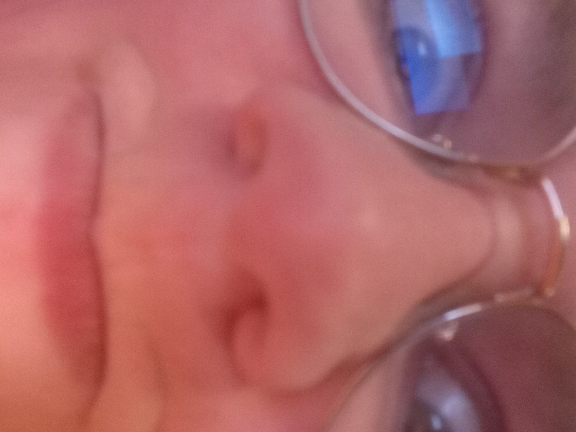 A close-up, blurred image shows a person's face with glasses. The nose and lips are visible, and reflections of a blue light are seen in the lenses of the glasses. The location of the image is unknown.