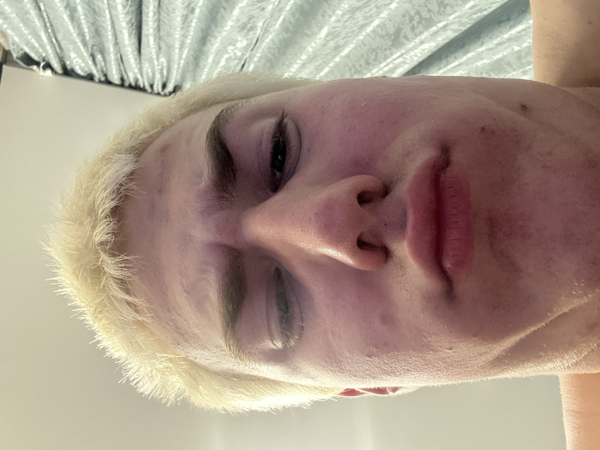 A close-up, low-angle portrait features a person with light blonde hair, looking down towards the camera. The individual has fair skin, which appears somewhat reddened or blotchy, particularly around the cheeks and nose, and shows some small blemishes or pimples. Their dark eyebrows contrast with their light hair. The eyes are partially closed or squinting, giving a relaxed or introspective expression, with the pupils visible. Full, pink lips are slightly parted. Fine, light hair is visible along the jawline and neck area. The background behind the person's head includes a plain, light-colored surface, possibly a wall or ceiling. Above this, a textured, light grey or silver element, resembling a venetian blind or a crinkled metallic fabric, is visible. The lighting is soft and appears to come from above. No text is visible.