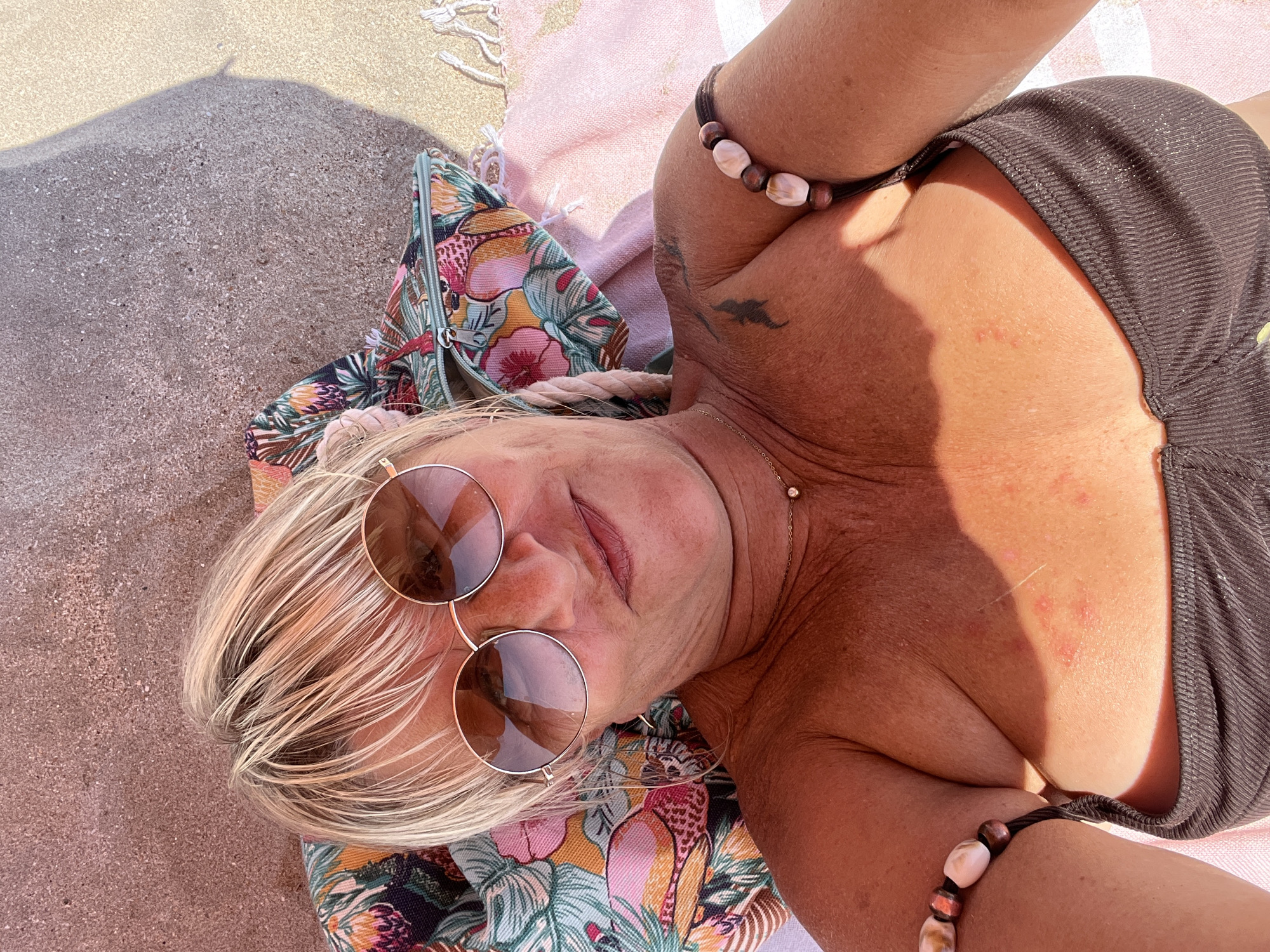 In Villeneuve-lès-Maguelone, France, a woman with blonde hair and sunglasses lies on a beach blanket on the sand. She is wearing a strapless brown top. Her skin appears tanned, and there are some red spots visible on her chest. She has a necklace on and a bracelet on her right arm made of beads. A patterned bag is behind her head, and a striped towel is visible below her. The background is sand and a shadow.