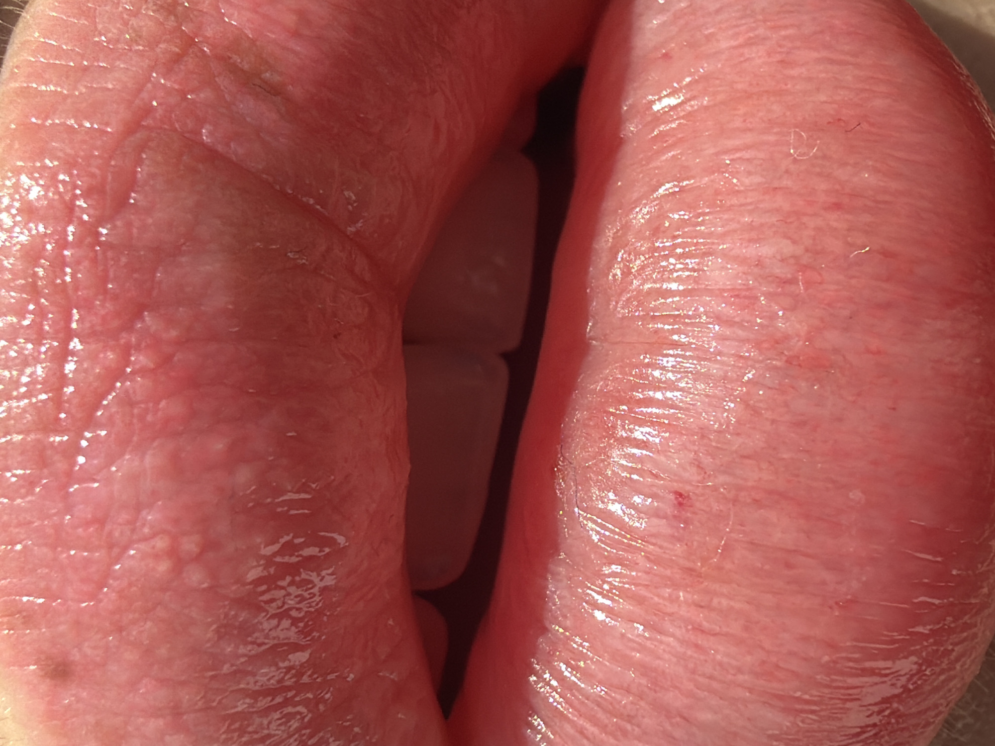 The image displays an extreme close-up, eye-level view of a human mouth with lips slightly parted. Both the upper and lower lips appear full and well-hydrated, exhibiting a glossy sheen that highlights their natural reddish-pink color. The intricate texture of the lip skin is clearly visible, showing fine vertical lines and numerous tiny, light-colored bumps, consistent with natural skin features or Fordyce spots.
Through the narrow opening between the lips, several white teeth are partially visible against the darker interior of the mouth. The lighting, possibly natural, accentuates the moist surface of the lips. Upon closer examination, a few slender, light-colored fibers or hairs are discernible on the lip surface, particularly towards the right side of the frame. A small red speck or mark is also visible on the lower right lip. The focus is entirely on the mouth, revealing detailed anatomical features without any discernible background, external objects, text, or location cues.