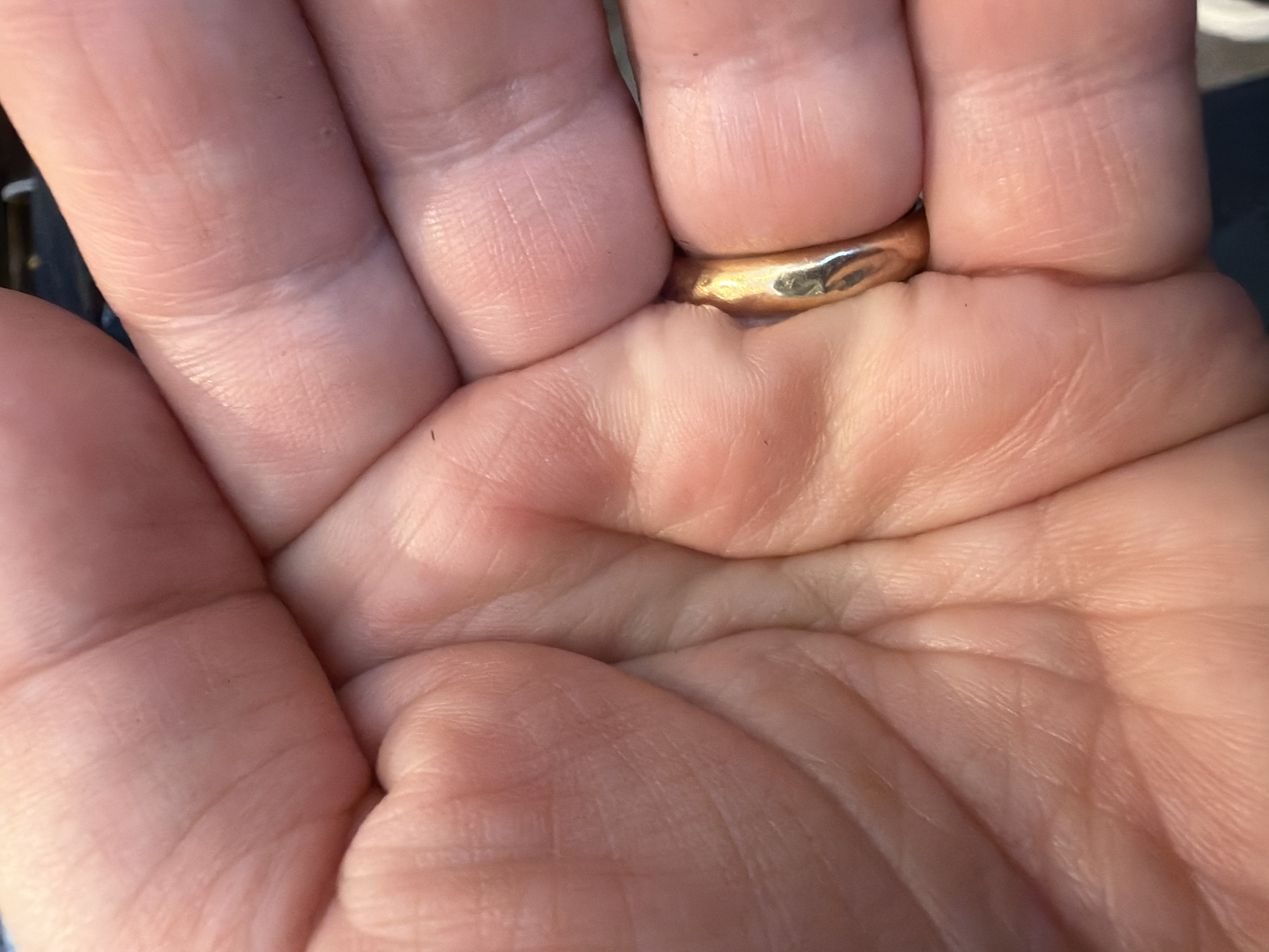 The image shows a close-up of a human hand, with a gold ring on one of the fingers. The skin has visible creases and lines, suggesting an adult hand. The background is out of focus, but appears to be dark fabric. There are no other objects or people visible in the image. The lighting suggests an indoor environment.