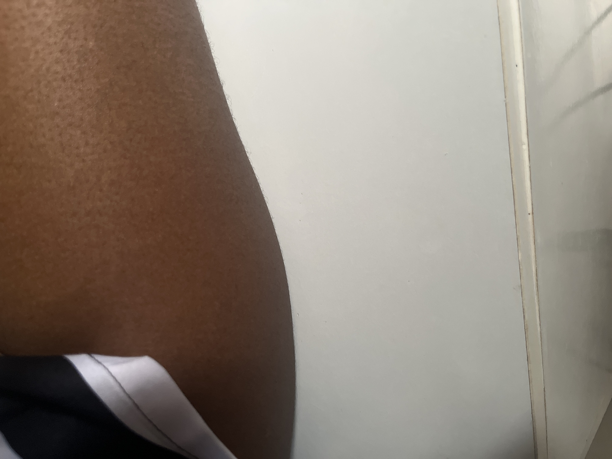 The image shows a close-up view of a person's arm, which is dark-skinned and appears to have goosebumps. The arm is positioned against a white, textured surface that resembles a wall or a door. The lower part of the image shows a glimpse of clothing with black and white stripes. The lighting suggests an indoor environment. The image is cropped tightly, focusing on the texture of the skin and the surrounding surface, with no discernible features of the city of Abuja, Nigeria.