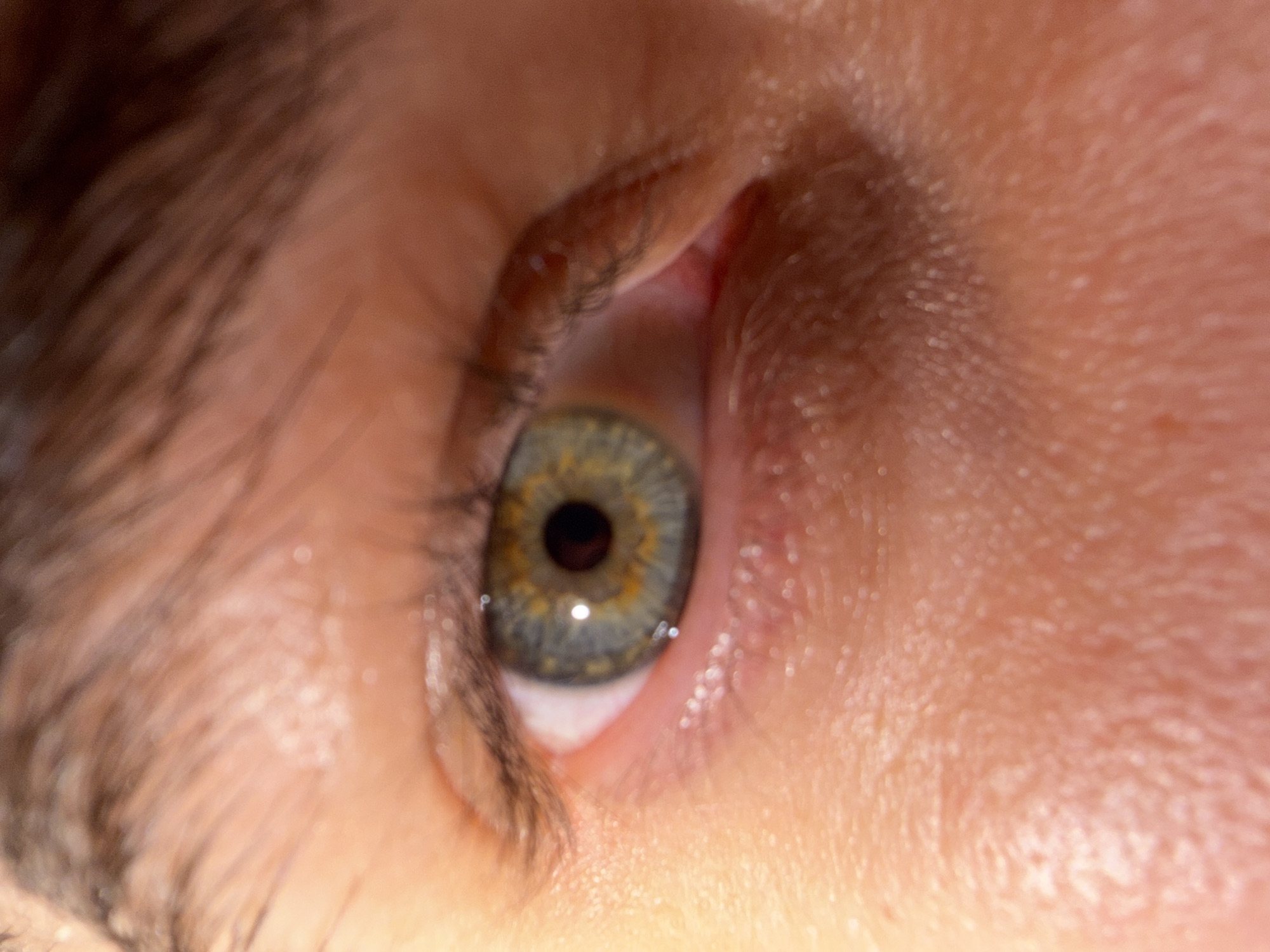 A close-up, macro photograph of a human eye. The iris is a mottled green and yellow with a dark brown pupil. The sclera is white with visible blood vessels. The surrounding skin is light-toned with visible pores and fine hairs. The eyebrow is dark brown and out of focus in the upper portion of the image. The lighting suggests a warm, bright light source coming from the left. This image does not contain any information that would indicate its location in Bangkok, Thailand, or any other specific geographical area.