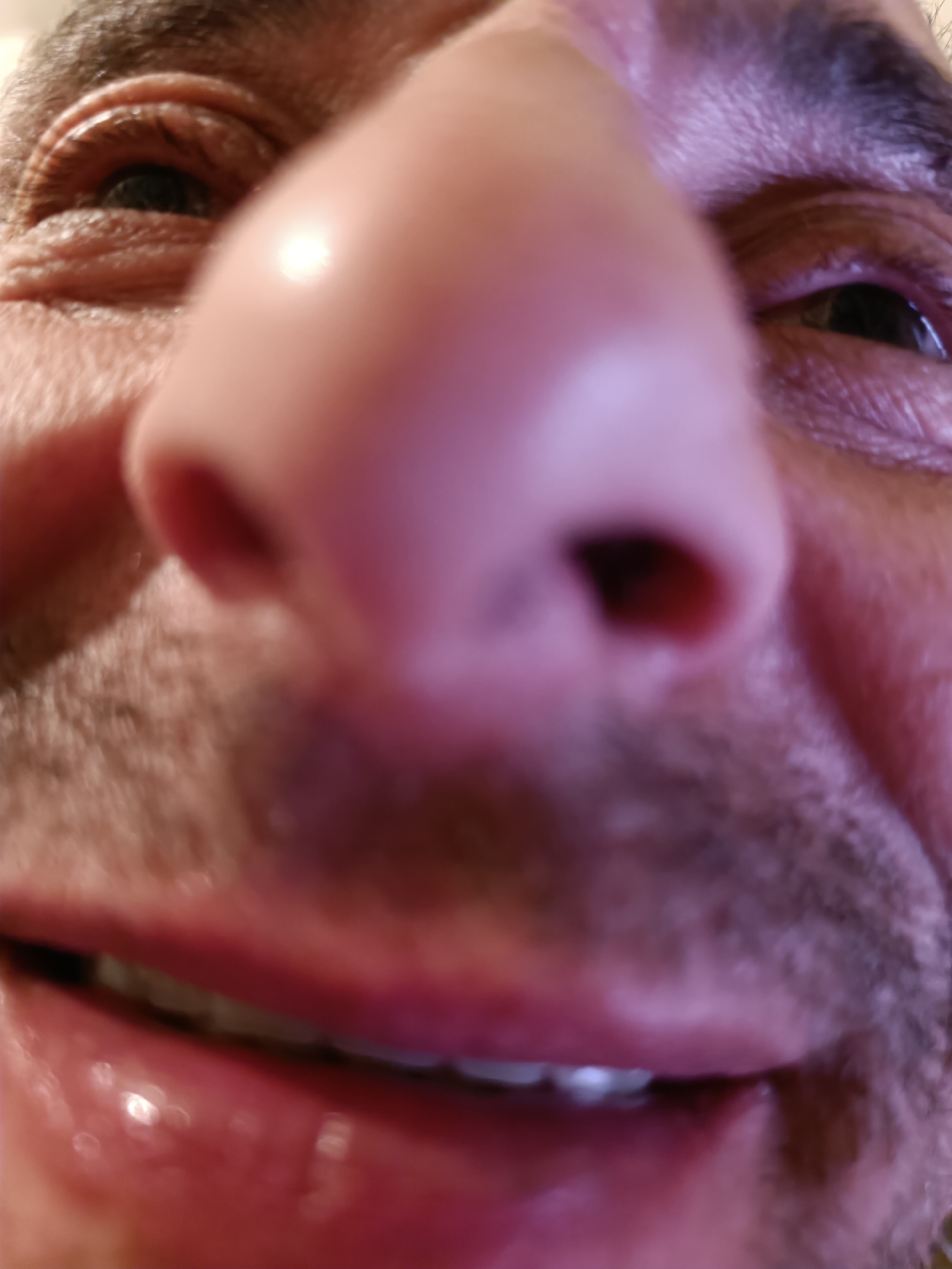 The image is a close-up, low-angle shot of a person's face, primarily focusing on their nose and mouth. The lighting appears to be artificial and casts a pinkish hue across the skin. The nose is large and fills a significant portion of the frame, with visible pores. The mouth is open, revealing teeth and the inside of the mouth, with the lips appearing moist and glossy. The skin shows texture and some stubble, suggesting a male subject. The background is out of focus and undiscernible. There is no information in the image to indicate a location in Zelenograd, Russia.