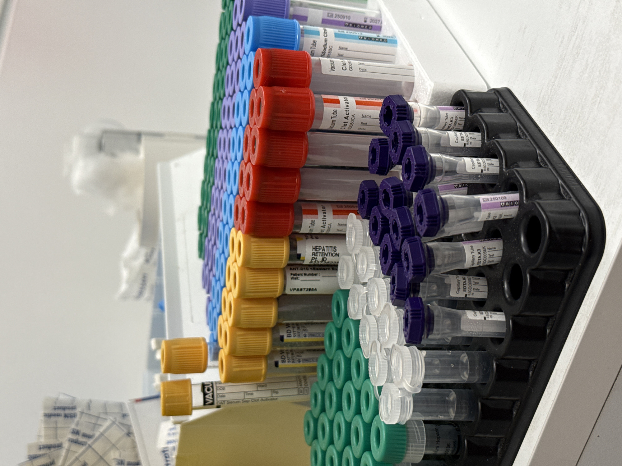 A close-up, clinical photograph displays a black rack filled with numerous vacuum blood collection tubes. The tubes are arranged in rows, identifiable by their color-coded tops: blue, red, purple, yellow, white, and green. Labels on the tubes indicate different additives and uses, with visible text including "Sodium Citrate," "Clot Activator," "HEPATITIS RETENTION," and "EDTA.K3." Some labels also provide space for patient information. The rack rests on a white surface in what appears to be a medical setting. There is no mention of the location in the city of Pleven, Bulgaria.