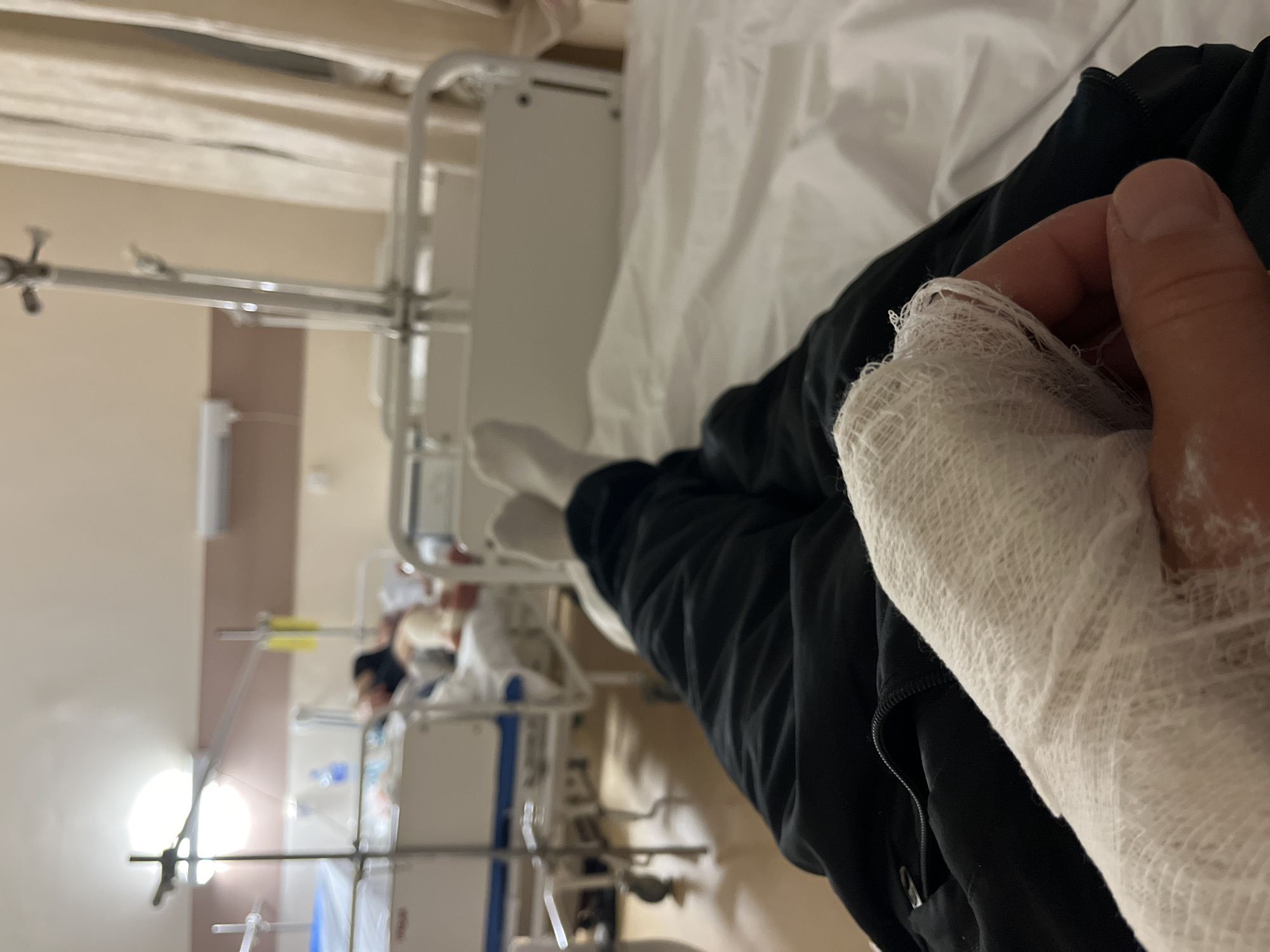 The image depicts a person lying in a hospital bed, with their right hand heavily bandaged. The person is wearing black pants. The bed has white sheets and a metal frame. In the background, other hospital beds and medical equipment are visible. The location appears to be a hospital ward. The city and specific location are unknown.