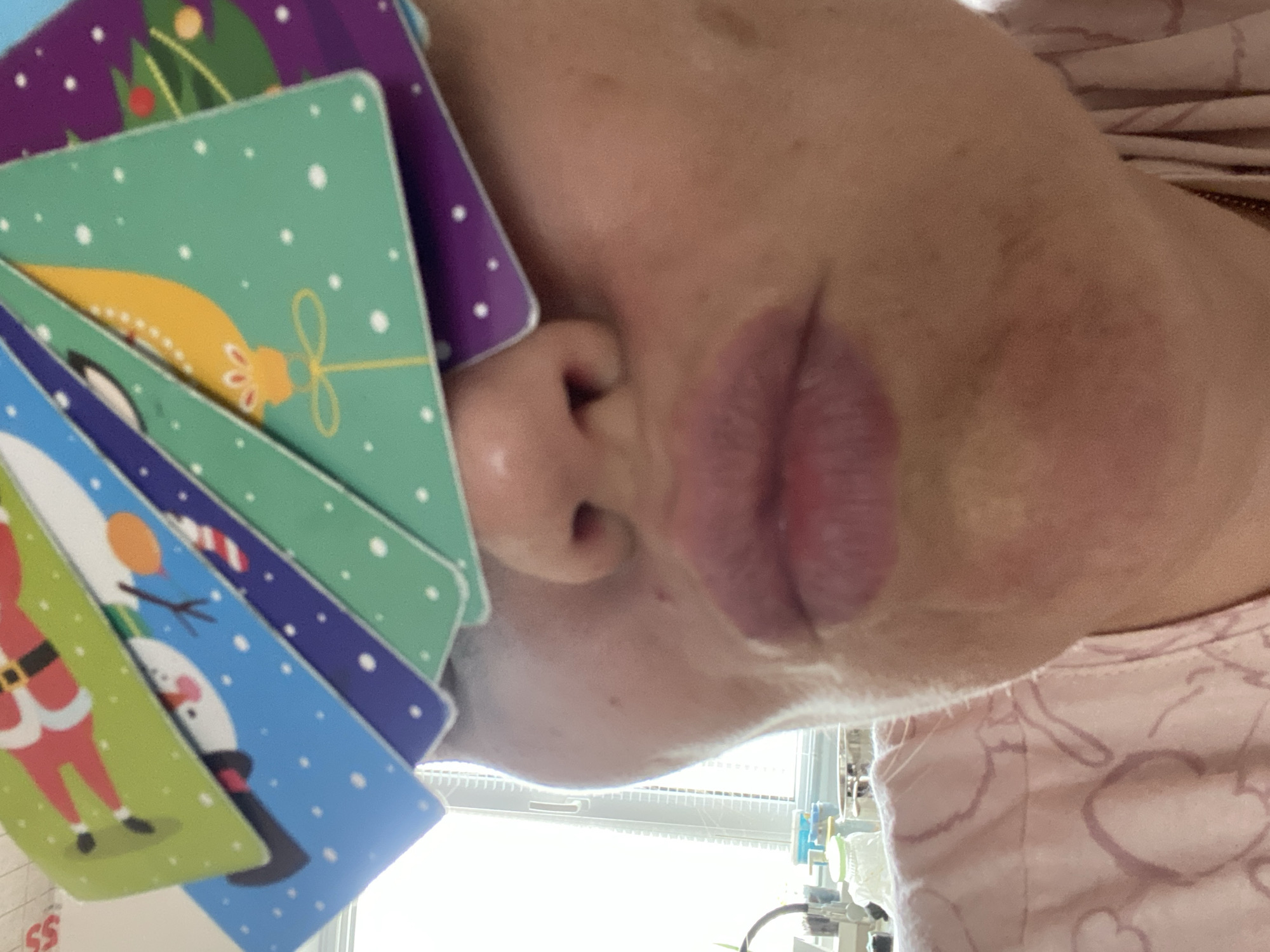 An upward-facing close-up shot shows a person's face, partially obscured by a stack of Christmas-themed cards. The cards feature images of a Christmas tree, a gold ornament, Santa Claus, and a snowman. The person is wearing a pink shirt with a heart pattern. A medical facility is visible in the background with visible medical equipment.
There is no information in this image to confirm it is located in Chaikovsky, Russia.