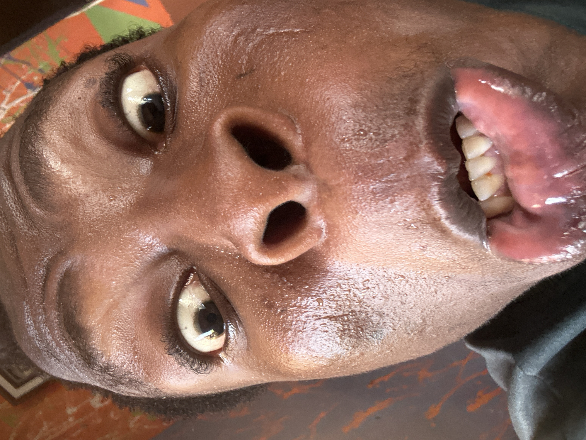 The image presents an extreme close-up of a person's face, rotated approximately 90 degrees clockwise. The subject has a dark skin tone and is looking directly towards the viewer with wide, alert eyes. Their mouth is open, revealing several white teeth, the reddish-purple interior of the mouth, and part of the tongue or inner lip.
The skin on the face appears shiny, suggesting sweat or moisture, with noticeable highlights on the forehead, nose, and around the mouth. Minor textural details, including small blemishes and faint linear scars, are visible on the skin. The whites of the eyes show a slight yellowish tint, and reflections are present in the dark pupils. Short, dark, curly hair is visible along the top edge of the head in the rotated orientation. A dark, possibly fabric, material is visible along the lower right edge of the frame. In the background, blurred hints of a colorful, abstract pattern with orange, green, and dark tones are discernible. The expression conveys intensity, possibly surprise or an active moment. No text is visible in the image. The location and time of day are unknown.